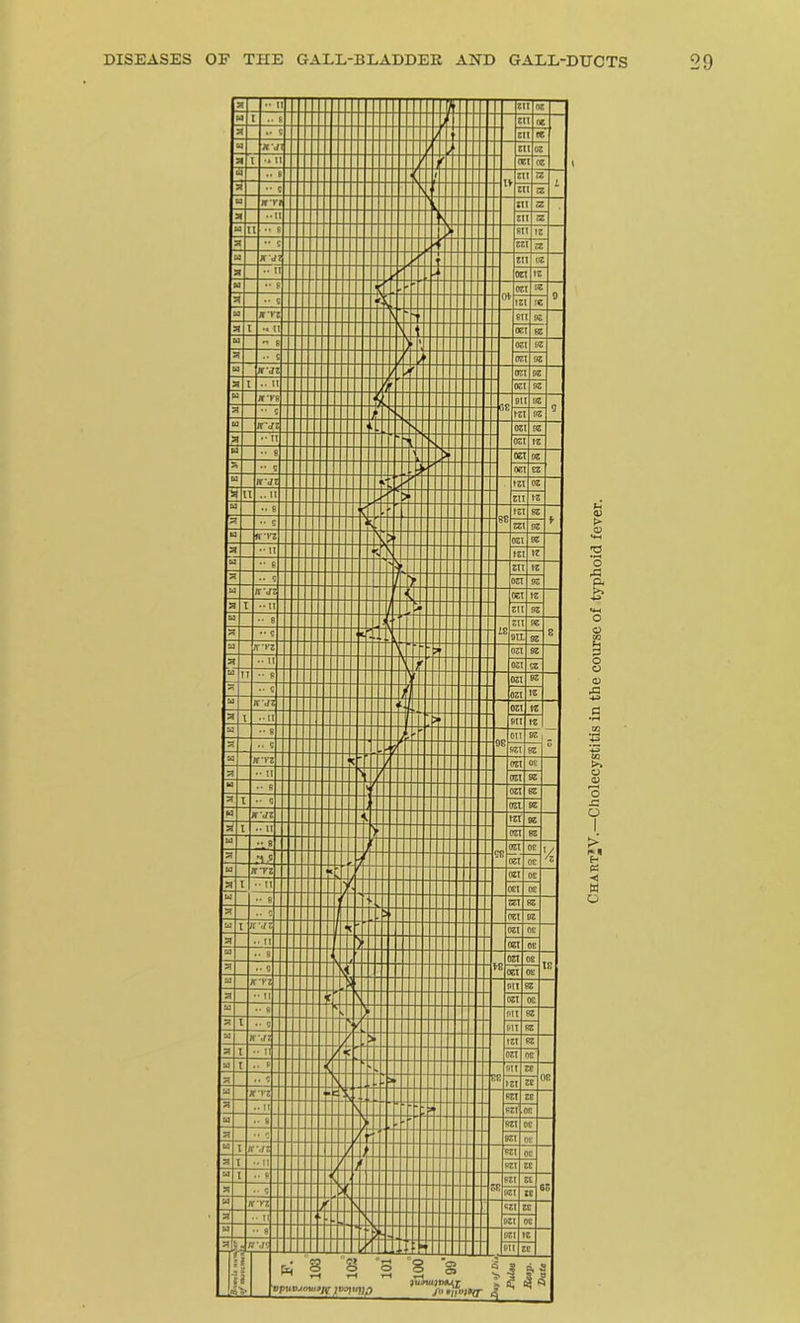 Chart* V.—Cholecystitis in the course of typhoid fever.