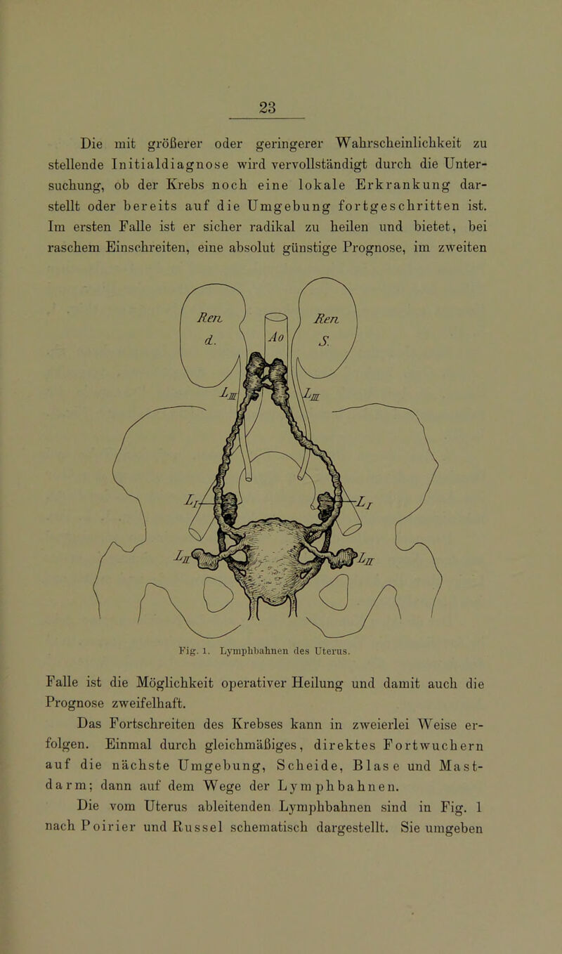 Die mit größerer oder geringerer Wahrscheinlichkeit zu stellende Initialdiagnose wird vervollständigt durch die Unter- suchung, ob der Krebs noch eine lokale Erkrankung dar- stellt oder bereits auf die Umgebung fortgeschritten ist. Im ersten Falle ist er sicher radikal zu heilen und bietet, bei raschem Einschreiten, eine absolut günstige Prognose, im zweiten Falle ist die Möglichkeit ojierativer Heilung und damit auch die Prognose zweifelhaft. Das Fortschreiten des Krebses kann in zweierlei Weise er- folgen. Einmal durch gleichmäßiges, direktes Fort wuchern auf die nächste Umgebung, Scheide, Blase und Mast- darm; dann auf dem Wege der Ly mph bahnen. Die vom Uterus ableitenden Lymphbahnen sind in Fig. 1 nachPoirier und Rüssel schematisch dargestellt. Sie umgeben