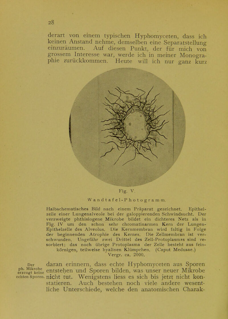 Der ph. Mikrobe erzeugt keine echten Sporen. derart von einem typischen Hyphomyceten, dass ich keinen Anstand nehme, demselben eine Separatstellung einzuräumen. Auf diesen Punkt, der für mich von grossem Interesse war, werde ich in meiner Monogra- phie zurückkommen. Heute will ich nur ganz kurz Fig. v. Wandtafel-Photogramm. Halbschematisches Bild nach einem Präparat gezeichnet. Epithel- zelle einer Lungenalveole bei der galoppierenden Schwindsucht. Der verzweigte phthisiogene Mikrobe bildet ein dichteres Netz als in Fig. IV um den schon sehr chromatinarmen Kern der Lungen- Epithelzelle des Alveolus. Die Kernmembran wird faltig in Folge der beginnenden Atrophie des Kernes. Die Zellmembran ist ver- schwunden. Ungefähr zwei Drittel des Zell-Protoplasmas sind re- sorbiert; das noch übrige Protoplasma der Zelle besteht aus fein- körnigen, teilweise hyalinen Klümpchen. (Caput Medusae.) Vergr. ca. 2000. daran erinnern, dass echte Hyphomyceten aus Sporen entstehen und Sporen bilden, was unser neuer Mikrobe nicht tut. Wenigstens liess es sich bis jetzt nicht kon- statieren. Auch bestehen noch viele andere wesent- liche Unterschiede, welche den anatomischen Charak-