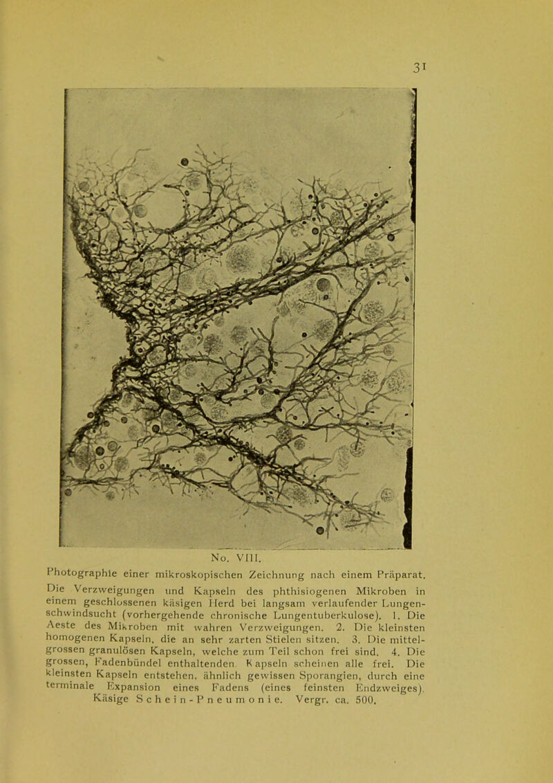 Photographie einer mikroskopischen Zeichnung nach einem Präparat. Die Verzweigungen und Kapseln des phthisiogenen Mikroben in einem geschlossenen käsigen Herd bei langsam verlaufender Lungen- schwindsucht (vorhergehende chronische Lungentuberkulose). 1. Die Aeste des Mikroben mit wahren Verzweigungen. 2. Die kleinsten homogenen Kapseln, die an sehr zarten Stielen sitzen. 3. Die mittel- grossen granulösen Kapseln, welche zum Teil schon frei sind. 4. Die grossen, hadenbündel enthaltenden Kapseln scheinen alle frei. Die kleinsten Kapseln entstehen, ähnlich gewissen Sporangien, durch eine terminale Expansion eines Fadens (eines feinsten Endzweiges). Käsige Schein-Pneumonie. Vergr. ca. 500.