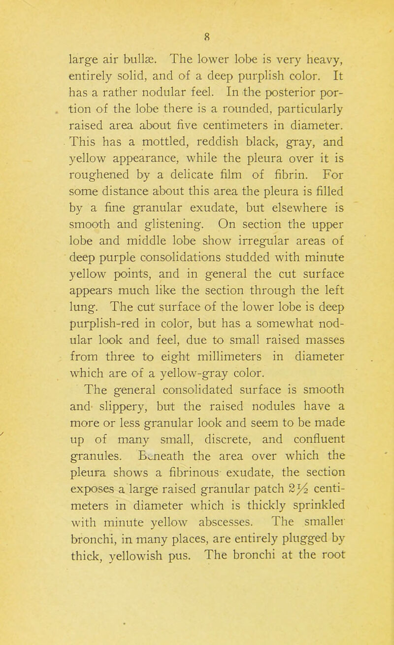 large air bullje. The lower lobe is very heavy, entirely solid, and of a deep purplish color. It has a rather nodular feel. In the posterior por- . tion of the lobe there is a rounded, particularly raised area about five centimeters in diameter. This has a mottled, reddish black, gray, and yellow appearance, while the pleura over it is roughened by a delicate film of fibrin. For some distance about this area the pleura is filled by a fine granular exudate, but elsewhere is smooth and glistening. On section the upper lobe and middle lobe show irregular areas of deep purple consolidations studded with minute yellow points, and in general the cut surface appears much like the section through the left lung. The cut surface of the lower lobe is deep purplish-red in color, but has a somewhat nod- ular look and feel, due to small raised masses from three to eight millimeters in diameter which are of a yellow-gray color. The general consolidated surface is smooth and- slippery, but the raised nodules have a more or less granular look and seem to be made up of many small, discrete, and confluent granules. Beneath the area over which the pleura shows a fibrinous- exudate, the section exposes a large raised granular patch 2^^ centi- meters in diameter which is thickly sprinkled with minute yellow abscesses. The smaller bronchi, in many places, are entirely plugged by thick, yellowish pus. The bronchi at the root