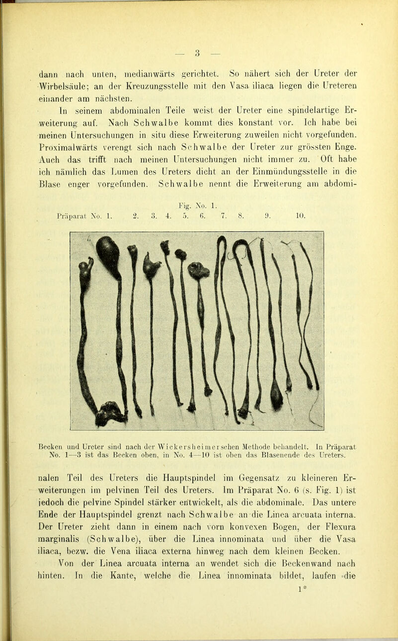 dann nach unten, inedianwärts gerichtet. So nähert sich der Ureter der Wirbelsäule; an der Kreuzungsstelle mit den Vasa iliaca liegen die Ureteren einander am nächsten. In seinem abdominalen Teile weist der Ureter eine spindelartige Er- weiterung auf. Nach Schwalbe kommt dies konstant vor. Ich habe bei meinen Untersuchungen in situ diese Erweiterung zuweilen nicht vorgefunden. Proximalwärts verengt sich nach Schwalbe der Ureter zur grössten Enge. Auch das trifft nach meinen Untersuchungen nicht immer zu. Oft habe ich nämlich das Lumen des Ureters dicht an der Einmündungsstelle in die Blase enger vorgefunden. Schwalbe nennt die Erweiterung am abdomi- Fig. No. 1. Präparat No. 1. 2. 3. 4. 5. 6. 7. 8. 9. 10. Becken und Ureter sind nach der Wickerslieimerschen Methode behandelt. In Präparat No. 1—3 ist das Becken oben, in No. 4—10 ist oben das Blasenende des Ureters. nalen Teil des Ureters die Hauptspindel im Gegensatz zu kleineren Er- weiterungen im pelvinen Teil des Ureters. Im Präparat No. 6 (s. Fig. 1) ist jedoch die pelvine Spindel stärker entwickelt, als die abdominale. Das untere Ende der Hauptspindel grenzt nach Schwalbe an die Linea arcuata interna. Der Ureter zieht dann in einem nach vorn konvexen Bogen, der Flexura marginalis (Schwalbe), über die Linea innominata und über die Vasa iliaca, bezw. die Vena iliaca externa hinweg nach dem kleinen Becken. Von der Linea arcuata interna an wendet sich die Beckenwand nach hinten. In die Kante, welche die Linea innominata bildet, laufen die 1*