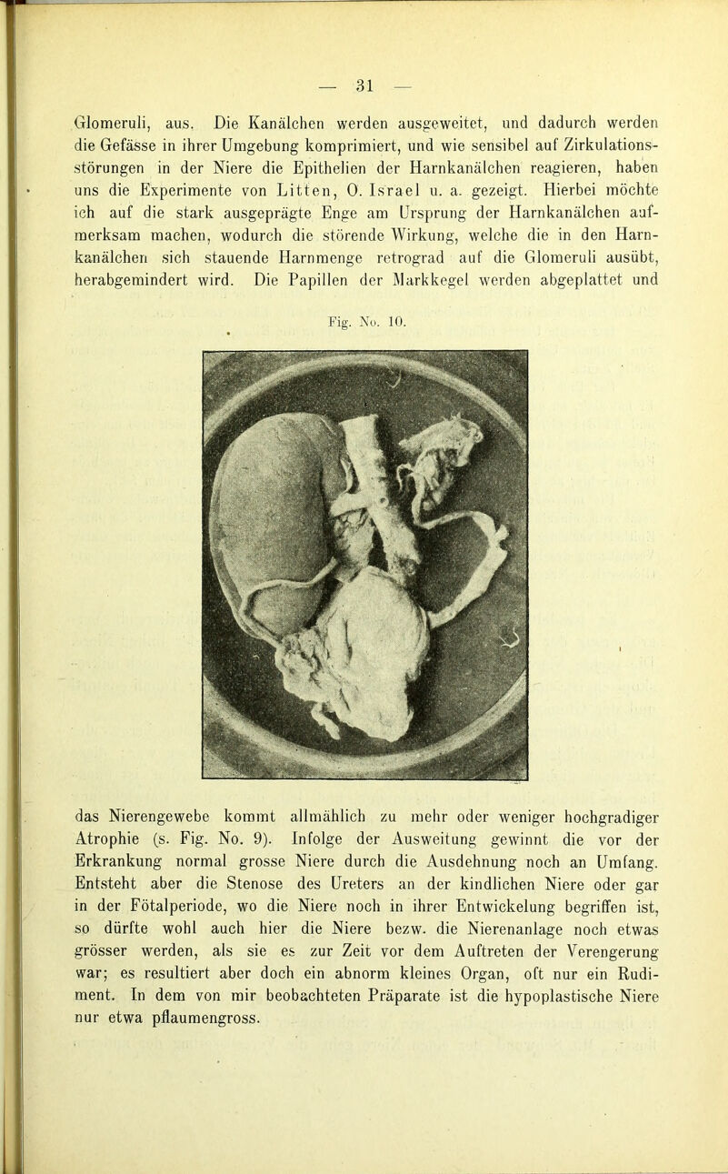 Glomeruli, aus. Die Kanälchen werden ausgeweitet, und dadurch werden die Gefässe in ihrer Umgebung komprimiert, und wie sensibel auf Zirkulations- störungen in der Niere die Epithelien der Harnkanälchen reagieren, haben uns die Experimente von Litten, 0. Israel u. a. gezeigt. Hierbei möchte ich auf die stark ausgeprägte Enge am Ursprung der Harnkanälchen auf- merksam machen, wodurch die störende Wirkung, welche die in den Harn- kanälchen sich stauende Harnmenge retrograd auf die Glomeruli ausübt, herabgemindert wird. Die Papillen der Markkegel werden abgeplattet und Fig. No. 10. das Nierengewebe kommt allmählich zu mehr oder weniger hochgradiger Atrophie (s. Fig. No. 9). Infolge der Ausweitung gewinnt die vor der Erkrankung normal grosse Niere durch die Ausdehnung noch an Umfang. Entsteht aber die Stenose des Ureters an der kindlichen Niere oder gar in der Fötalperiode, wo die Niere noch in ihrer Entwickelung begriffen ist, so dürfte wohl auch hier die Niere bezw. die Nierenanlage noch etwas grösser werden, als sie es zur Zeit vor dem Auftreten der Verengerung war; es resultiert aber doch ein abnorm kleines Organ, oft nur ein Rudi- ment. In dem von mir beobachteten Präparate ist die hypoplastische Niere nur etwa pflaumengross.