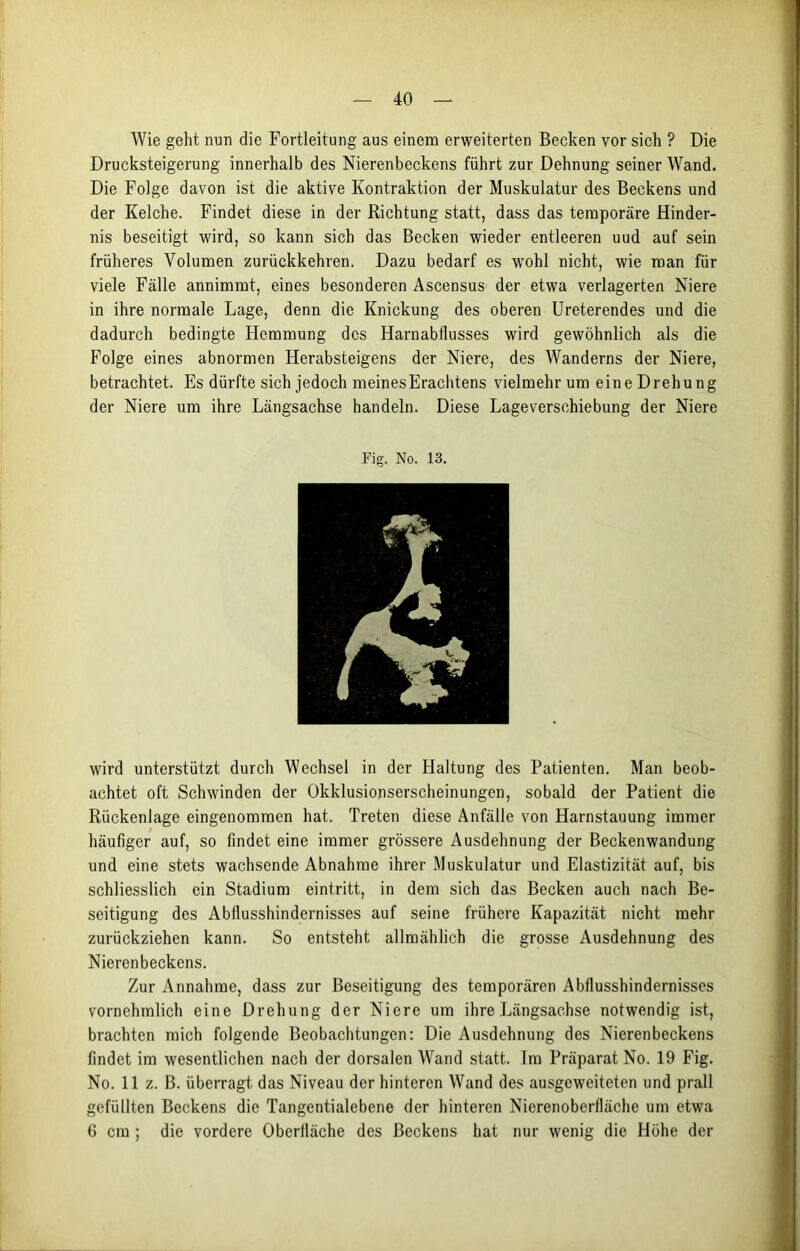 Wie geht nun die Fortleitung aus einem erweiterten Becken vor sich ? Die Drucksteigerung innerhalb des Nierenbeckens führt zur Dehnung seiner Wand. Die Folge davon ist die aktive Kontraktion der Muskulatur des Beckens und der Kelche. Findet diese in der Richtung statt, dass das temporäre Hinder- nis beseitigt wird, so kann sich das Becken wieder entleeren uud auf sein früheres Volumen zurückkehren. Dazu bedarf es wohl nicht, wie man für viele Fälle annimmt, eines besonderen Ascensus der etwa verlagerten Niere in ihre normale Lage, denn die Knickung des oberen Ureterendes und die dadurch bedingte Hemmung des Harnabflusses wird gewöhnlich als die Folge eines abnormen Herabsteigens der Niere, des Wanderns der Niere, betrachtet. Es dürfte sich jedoch meinesErachtens vielmehr um eine Drehung der Niere um ihre Längsachse handeln. Diese Lageverschiebung der Niere Fig. No. 13. wird unterstützt durch Wechsel in der Haltung des Patienten. Man beob- achtet oft Schwinden der Okklusionserscheinungen, sobald der Patient die Rückenlage eingenommen hat. Treten diese Anfälle von Harnstauung immer häufiger auf, so findet eine immer grössere Ausdehnung der Beckenwandung und eine stets wachsende Abnahme ihrer Muskulatur und Elastizität auf, bis schliesslich ein Stadium eintritt, in dem sich das Becken auch nach Be- seitigung des Abflusshindernisses auf seine frühere Kapazität nicht mehr zurückziehen kann. So entsteht allmählich die grosse Ausdehnung des Nierenbeckens. Zur Annahme, dass zur Beseitigung des temporären Abflusshindernisses vornehmlich eine Drehung der Niere um ihre Längsachse notwendig ist, brachten mich folgende Beobachtungen: Die Ausdehnung des Nierenbeckens findet im wesentlichen nach der dorsalen Wand statt. Im Präparat No. 19 Fig. No. 11 z. B. überragt das Niveau der hinteren Wand des ausgeweiteten und prall gefüllten Beckens die Tangentialebene der hinteren Nierenoberfläche um etwa 6 cm ; die vordere Oberfläche des Beckens hat nur wenig die Höhe der