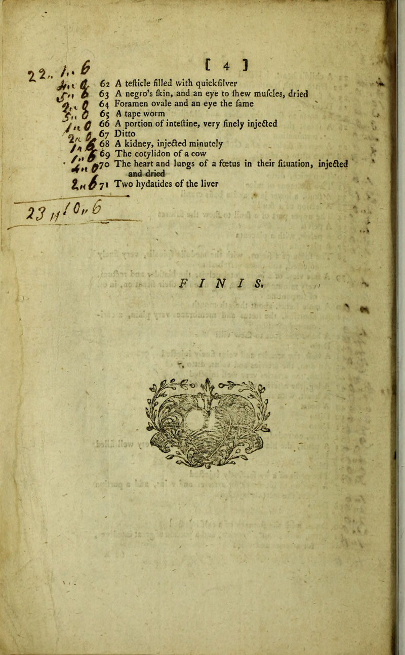 *2, /.• ^ Jt ^ I',: 2 j.iC Ik Un 1*6 ix C 4 3 A teflicle filled with quickfilver A negro’s fldn, and an eye to fhew mufcles, dried Foramen ovale and an eye the fame A tape worm A portion of inteftine, very finely injefted Ditto A kidney, inje&ed minutely The cotylidon of a cow The heart and lungs of a foetus in their Ikuation, inje&ed and dried Two hydatides of the liver 23 ft /C„b FINIS. ' H
