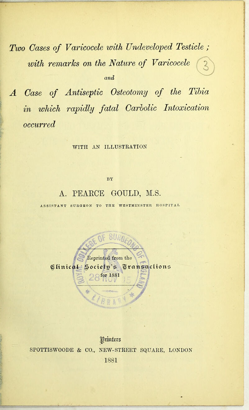 Two Cases of Varicocele with Undeveloped Testicle ; with remarks on the Nature of Varicocele and A Case of Antiseptic Osteotomy of the Tibia in which rapidly fatal Carbolic Intoxication occurred WITH AN ILLUSTRATION BY A. PEAECE GOULD, M.S. ASSISTANT SURGEON TO THE WESTMINSTER HOSPITAL gjsSr/. V Jb \ <g \ Reprinted from the (Stinical gocieta’o ^transaction; for 1881 4 O Ry U -e* , printers SPOTTISWOODE & CO., NEW-STREET SQUARE, LONDON 1881