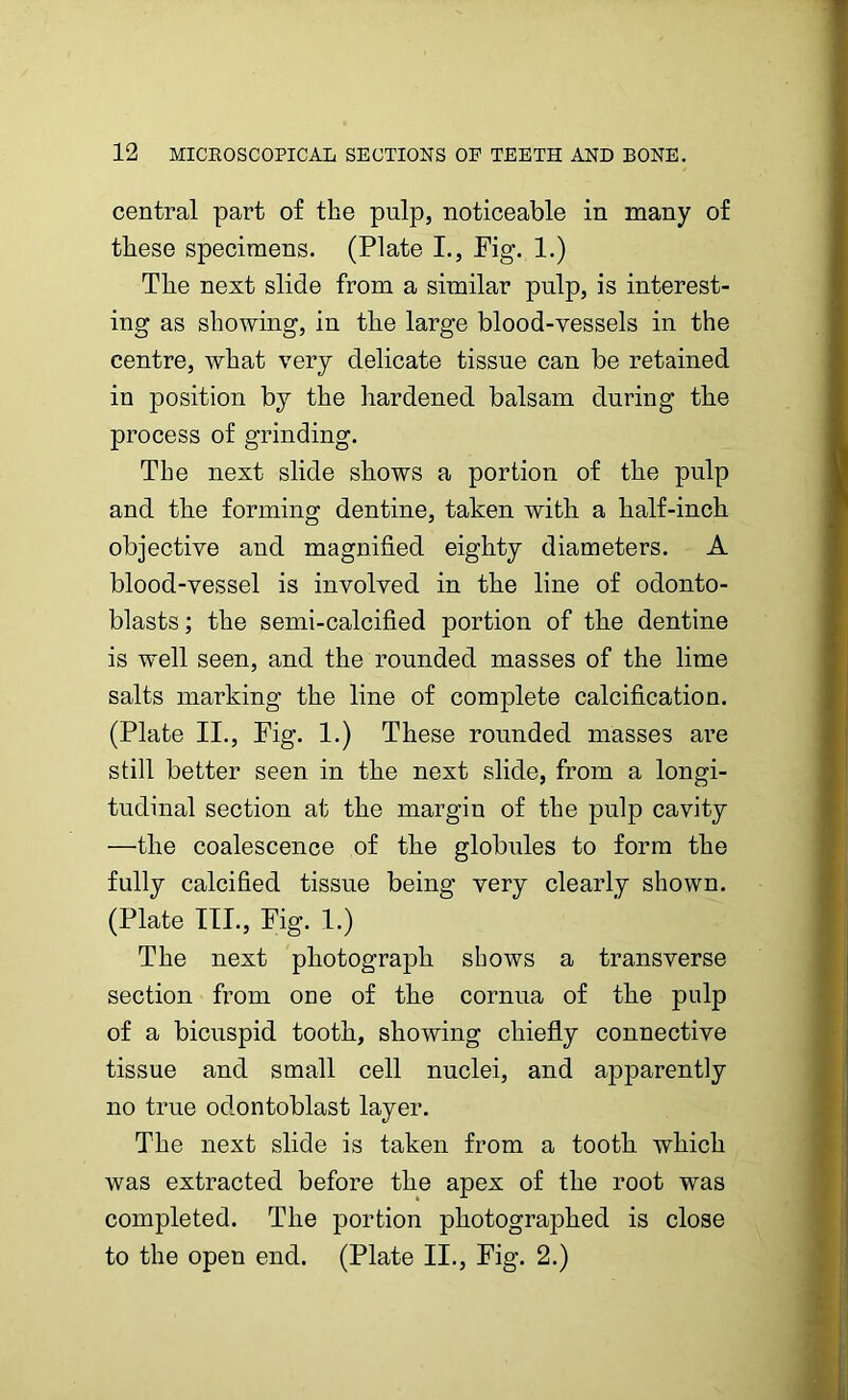 central part of the pulp, noticeable in many of these specimens. (Plate I., Pig. 1.) The next slide from a similar pulp, is interest- ing as showing, in the large blood-vessels in the centre, what very delicate tissue can be retained in position by the hardened balsam during the process of grinding. The next slide shows a portion of the pulp and the forming dentine, taken with a half-inch objective and magnified eighty diameters. A blood-vessel is involved in the line of odonto- blasts ; the semi-calcified portion of the dentine is well seen, and the rounded masses of the lime salts marking the line of complete calcification. (Plate II., Pig. 1.) These rounded masses are still better seen in the next slide, from a longi- tudinal section at the margin of the pulp cavity —the coalescence of the globules to form the fully calcified tissue being very clearly shown. (Plate III., Fig. 1.) The next photograph shows a transverse section from one of the cornua of the pulp of a bicuspid tooth, showing chiefly connective tissue and small cell nuclei, and apparently no true odontoblast layer. The next slide is taken from a tooth which was extracted before the apex of the root was completed. The portion photographed is close to the open end. (Plate II., Pig. 2.)