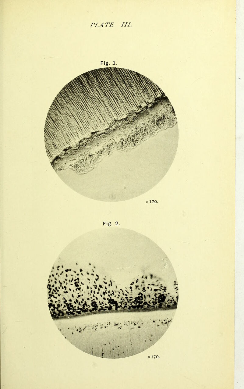 PLATE III. Fig. 1. x 1 70. Fig. 2.