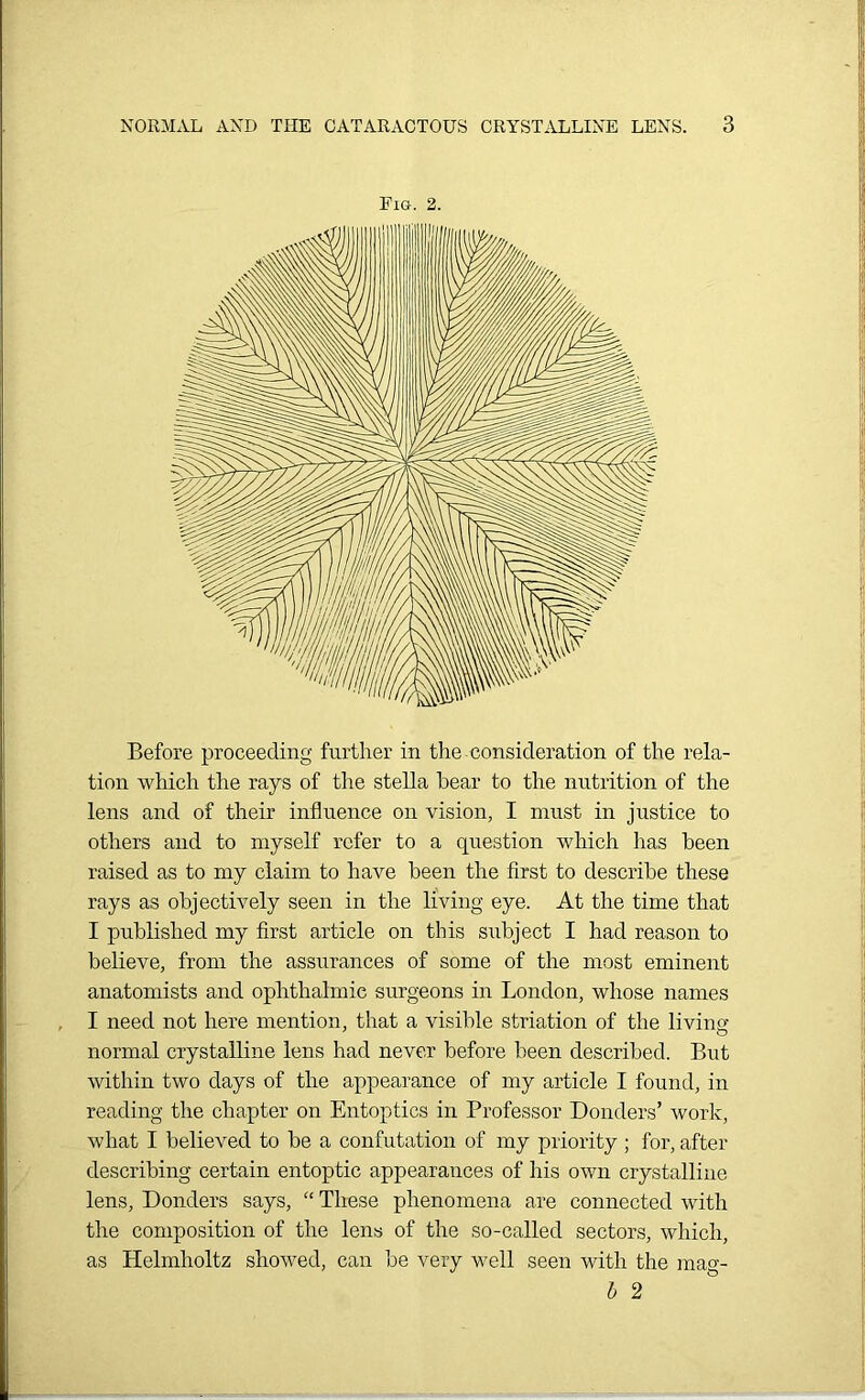 Fig. 2. Before proceeding further in the consideration of the rela- tion which the rays of the stella hear to the nutrition of the lens and of their influence on vision, I must in justice to others and to myself refer to a question which has been raised as to my claim to have been the first to describe these rays as objectively seen in the living eye. At the time that I published my first article on this subject I had reason to believe, from the assurances of some of the most eminent anatomists and ophthalmic surgeons in London, whose names I need not here mention, that a visible striation of the living- normal crystalline lens had never before been described. But within two days of the appearance of my article I found, in reading the chapter on Entoptics in Professor Donders’ work, what I believed to be a confutation of my priority; for, after describing certain entoptic appearances of his own crystalline lens, Donders says, “ These phenomena are connected with the composition of the lens of the so-called sectors, which, as Helmholtz showed, can be very well seen with the ma°- b 2