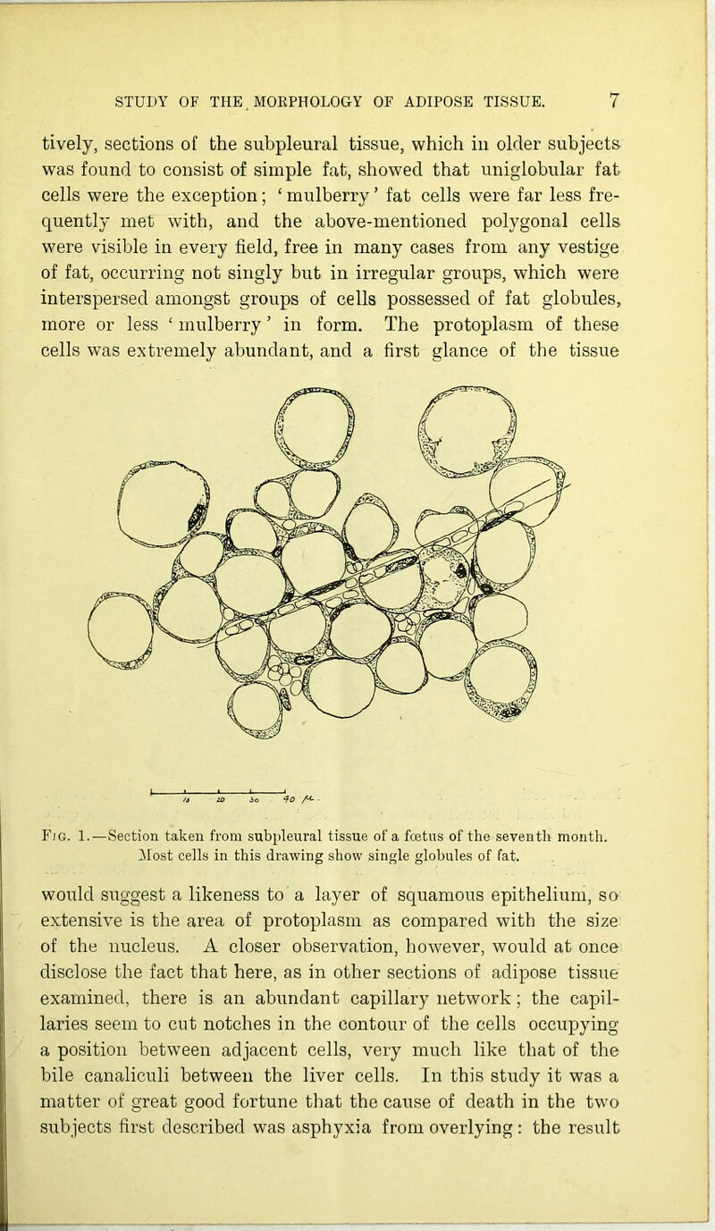 tively, sections of the subpleural tissue, which in older subjects was found to consist of simple fat, showed that uniglobular fat cells were the exception; ‘ mulberry ’ fat cells were far less fre- quently met with, and the above-mentioned polygonal cells were visible in every field, free in many cases from any vestige of fat, occurring not singly but in irregular groups, which were interspersed amongst groups of cells possessed of fat globules, more or less ‘ mulberry ’ in form. The protoplasm of these cells was extremely abundant, and a first glance of the tissue * /a 20 io 40 /*- ■ Fig. 1.—Section taken from subpleural tissue of a fcetus of the seventh month. Most cells in this drawing show single globules of fat. would suggest a likeness to a layer of squamous epithelium, so extensive is the area of protoplasm as compared with the size of the nucleus. A closer observation, however, would at once disclose the fact that here, as in other sections of adipose tissue examined, there is an abundant capillary network; the capil- laries seem to cut notches in the contour of the cells occupying a position between adjacent cells, very much like that of the bile canaliculi between the liver cells. In this study it was a matter of great good fortune that the cause of death in the two subjects first described was asphyxia from overlying : the result