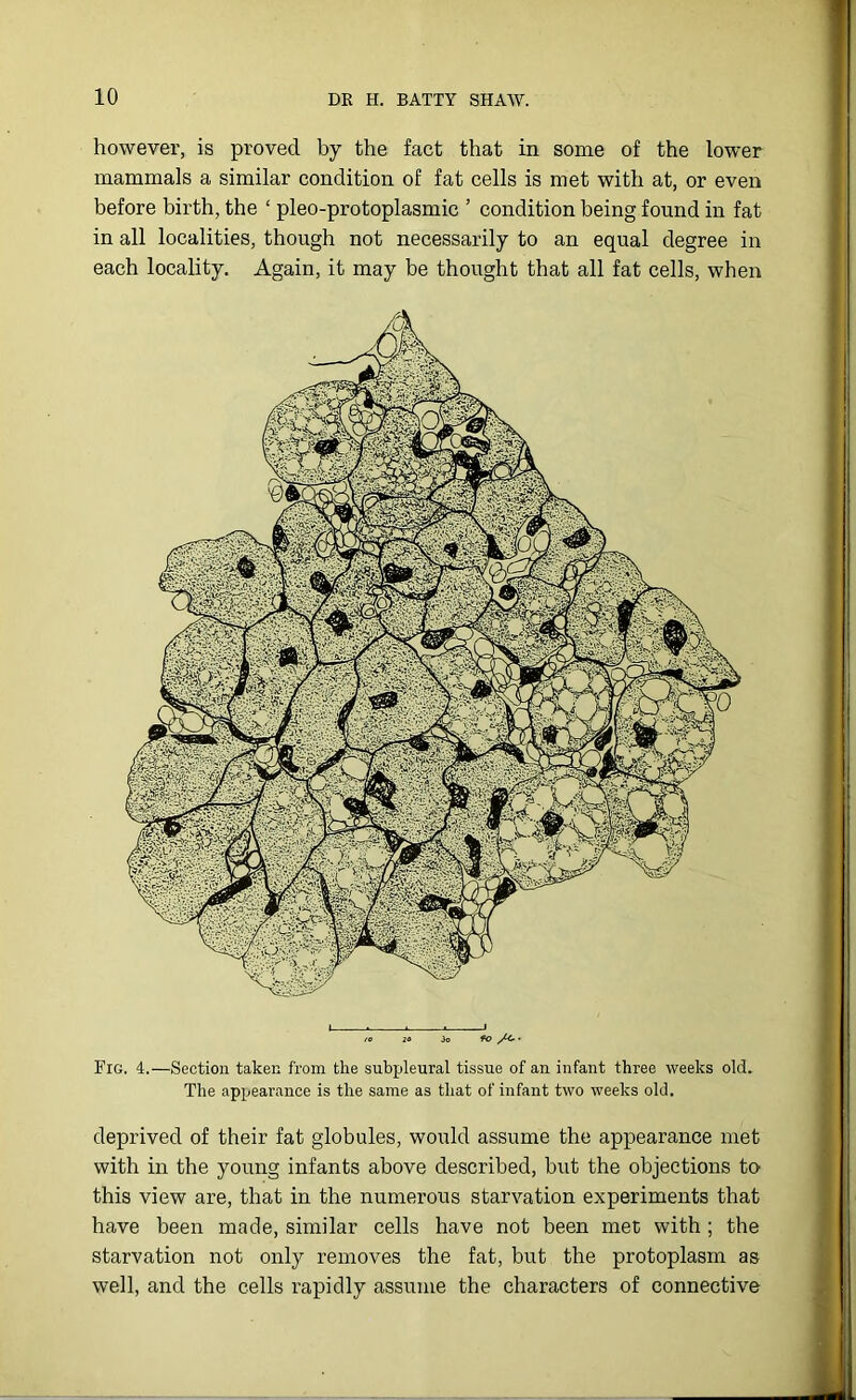 Fig. 4.—Section taken from the subpleural tissue of an infant three weeks old. The appearance is the same as that of infant two weeks old. deprived of their fat globules, would assume the appearance met with in the young infants above described, but the objections to this view are, that in the numerous starvation experiments that have been made, similar cells have not been met with; the starvation not only removes the fat, but the protoplasm as well, and the cells rapidly assume the characters of connective however, is proved by the fact that in some of the lower mammals a similar condition of fat cells is met with at, or even before birth, the ‘ pleo-protoplasmic ’ condition being found in fat in all localities, though not necessarily to an equal degree in each locality. Again, it may be thought that all fat cells, when 90 /<■ •