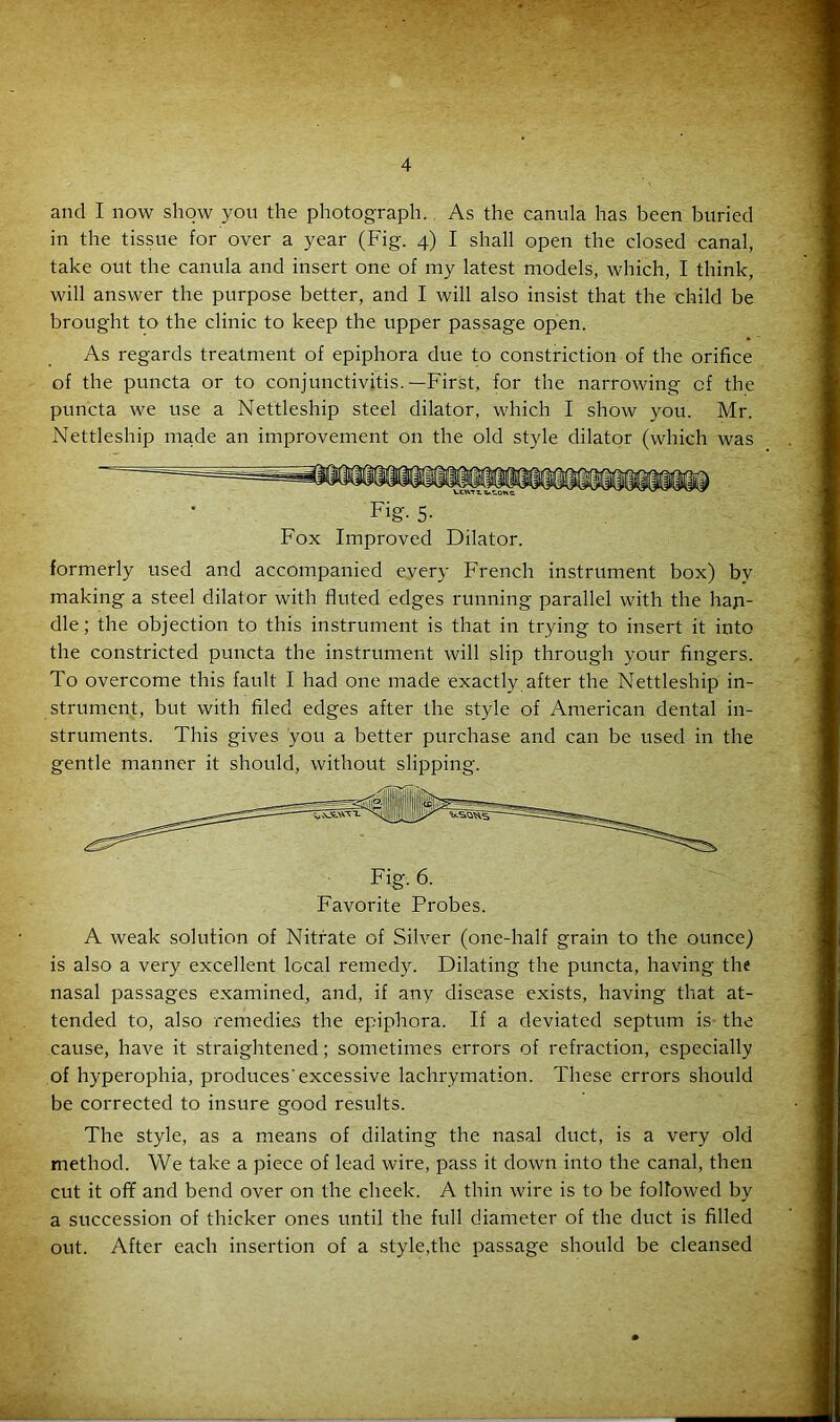 and I now show you the photograph. As the canula has been buried in the tissue for over a year (Fig. 4) I shall open the closed canal, take out the canula and insert one of my latest models, which, I think, will answer the purpose better, and I will also insist that the child be brought to the clinic to keep the upper passage open. As regards treatment of epiphora due to constriction of the orifice of the puncta or to conjunctivitis.—First, for the narrowing cf the puncta we use a Nettleship steel dilator, which I show you. Mr. Nettleship made an improvement on the old style dilator (which was Fig'- 5- Fox Improved Dilator. formerly used and accompanied every French instrument box) by making a steel dilator with fluted edges running parallel with the han- dle ; the objection to this instrument is that in trying to insert it into the constricted puncta the instrument will slip through your fingers. To overcome this fault I had one made exactly after the Nettleship in- strument, but with filed edges after the style of American dental in- struments. This gives you a better purchase and can be used in the gentle manner it should, without slipping. A weak solution of Nitrate of Silver (one-half grain to the ounce) is also a very excellent local remedy. Dilating the puncta, having the nasal passages examined, and, if any disease exists, having that at- tended to, also remedies the epiphora. If a deviated septum is the cause, have it straightened; sometimes errors of refraction, especially of hyperophia, produces'excessive lachrymation. These errors should be corrected to insure good results. The style, as a means of dilating the nasal duct, is a very old method. We take a piece of lead wire, pass it down into the canal, then cut it off and bend over on the cheek. A thin wire is to be followed by a succession of thicker ones until the full diameter of the duct is filled out. After each insertion of a style,the passage should be cleansed