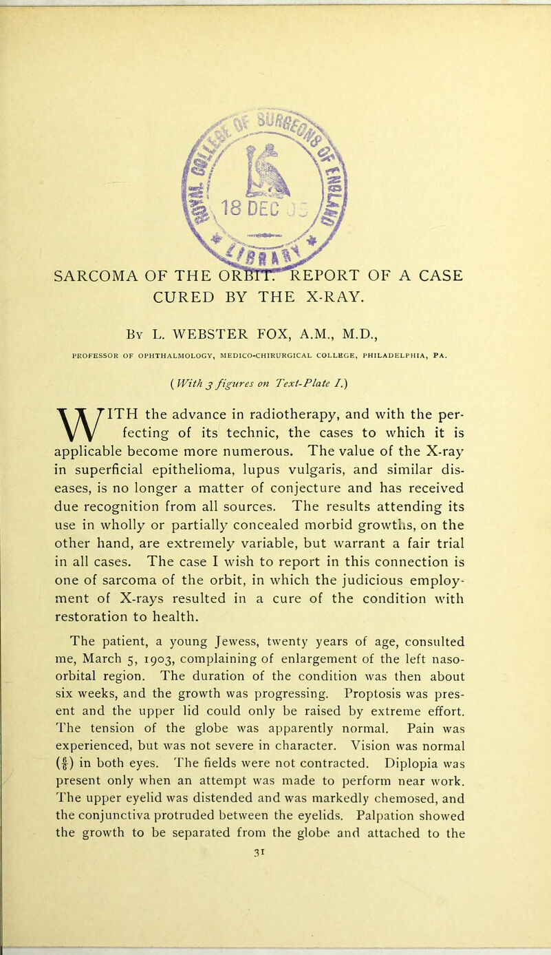 By L. WEBSTER FOX, A.M., M.D., PROFESSOR OF OPHTHALMOLOGY, MEDICO-CHIRURGICAL COLLEGE, PHILADELPHIA, PA. ( With 3 figures on Text-Plate /.) WITH the advance in radiotherapy, and with the per- fecting of its technic, the cases to which it is applicable become more numerous. The value of the X-ray in superficial epithelioma, lupus vulgaris, and similar dis- eases, is no longer a matter of conjecture and has received due recognition from all sources. The results attending its use in wholly or partially concealed morbid growths, on the other hand, are extremely variable, but warrant a fair trial in all cases. The case I wish to report in this connection is one of sarcoma of the orbit, in which the judicious employ- ment of X-rays resulted in a cure of the condition with restoration to health. The patient, a young Jewess, twenty years of age, consulted me, March 5, 1903, complaining of enlargement of the left naso- orbital region. The duration of the condition was then about six weeks, and the growth was progressing. Proptosis was pres- ent and the upper lid could only be raised by extreme effort. The tension of the globe was apparently normal. Pain was experienced, but was not severe in character. Vision was normal (f) in both eyes. The fields were not contracted. Diplopia was present only when an attempt was made to perform near work. The upper eyelid was distended and was markedly chemosed, and the conjunctiva protruded between the eyelids. Palpation showed the growth to be separated from the globe and attached to the