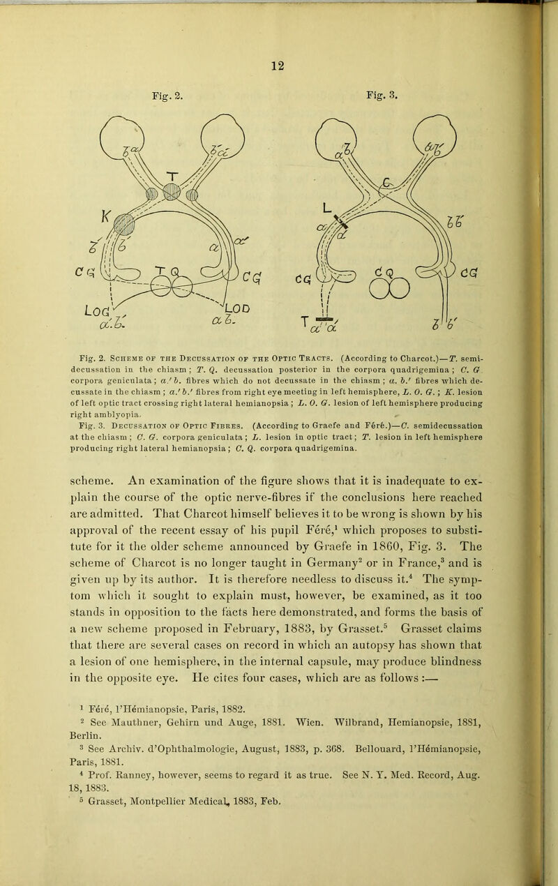 Fig. 2. Fig. 3. Fig. 2. Scheme of the Decussation of the Optic Tracts. (According to Charcot.)—T. semi- decussation in the chiasm; T. Q. decussation posterior in the corpora quadrigemiQa ; C. G corpora geniculata; a.'b. fibres which do not decussate in the chiasm; a. b.' fibres which de- cussate in the chiasm ; a.' b.' fibres from right eye meeting in left hemisphere, L. 0. G. ; K. lesion of left optic tract crossing right lateral hemianopsia ; L. 0. G. lesion of left hemisphere producing right amblyopia, * Fig. 3. Decussation of Optic Fibres. (According to Graefe and F6re.)—C. semidecussation at the chiasm ; C. G. corpora geniculata ; L. lesion in optic tract; T. lesion in left hemisphere producing right lateral hemianopsia; C. Q. corpora quadrigemina. scheme. An examination of the figure shows that it is inadequate to ex- plain the course of the optic nerve-fibres if the conclusions here reached are admitted. That Charcot himself believes it to be wrong is shown by his approval of the recent essay of his pupil Fere,1 which proposes to substi- tute for it the older scheme announced by Graefe in 1860, Fig. 3. The scheme of Charcot is no longer taught in Germany2 or in France,3 and is given up by its author. It is therefore needless to discuss it.4 The symp- tom which it sought to explain must, however, be examined, as it too stands in opposition to the facts here demonstrated, and forms the basis of a new scheme proposed in February, 1883, by Grasset.5 Grasset claims that there are several cases on record in which an autopsy has shown that a lesion of one hemisphere, in the internal capsule, may produce blindness in the opposite eye. He cites four cases, which are as follows:— 1 Feie, l’Hemianopsie, Paris, 1882. 2 See Mautliner, Gehirn und Auge, 1881. Wien. Wilbrand, Hemianopsie, 18S1, Berlin. 3 See Archiv. d’Ophtlialmologie, August, 1883, p. 308. Bellouard, l’Hemianopsie, Paris, 1881. 4 Prof. Ranney, however, seems to regard it as true. See N. Y. Med. Record, Aug. 18, 1883. 5 Grasset, Montpellier Medical, 1883, Feb.