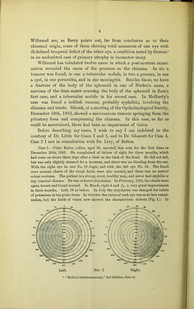 Wilbrand are, as Berry points out, far from conclusive as to their chiasmal origin, some of them showing total amaurosis of one eye with ill-defined temporal defect of the other eye. a condition noted by Gowers1 in an undoubted case of primary atrophy in locomotor ataxy. Wilbrand has tabulated twelve cases in which a post-mortem exami- nation revealed the cause of the pressure on the chiasma. In six a tumour was found, in one a tubercular nodule, in two a gumma, in one a cyst, in one periostitis, and in one meningitis. Besides these, we have a fracture of the body of the sphenoid in one of Nieden’s cases, a sarcoma of the dura mater covering the body of the sphenoid in Ross’s first case, and a tubercular nodule in his second case. In McHardy’s case was found a reddish tumour, probably syphilitic, involving the chiasma and tracts. Silcock, at a meeting of the Opthalmological Society, December 10th, 1883, showed a sarcomatous tumour springing from the pituatory fossa and compressing the chiasma. In this case, as far as could be ascertained, there had been no impairment of vision. Before describing my cases, I wish to say I am indebted to the courtesy of Dr. Little for Cases 1 and 3, and to Dr. Glascott for Case 4. Case 2 I saw in consultation with Dr. Livy, of Bolton. Case 1.—Peter Eaton, collier, aged 30, married, was seen for the first time on December 28th, 1883. He complained of failure of sight for three months, which had come on about three days after a blow on the back of the head. He did not fall, but was only slightly stunned for a moment, and there was no- bleeding from the ear. With the right eye he saw No. 19 Jager, and with the left eye No. 16. The fundi were normal, charts of the visual fields were also normal, and there was no central colour scotoma. The patient is a strong, stout, healthy man, and never had syphilis or any venereal disease. He was ordered strychnine. In February, 1884, the charts were again traced and found normal. In March, right 4 and T%, a very great improvement in three months. Left, 16 as before. In July the strychnine was changed for iodide of potassium in ten grain doses. In October the vision of each eye was as at last exami- nation, but the fields of vision now showed the characteristic defects (Fig. I.). In 1 “ Medical Ophthalmoscopy, 2nd Edition, Case 55.