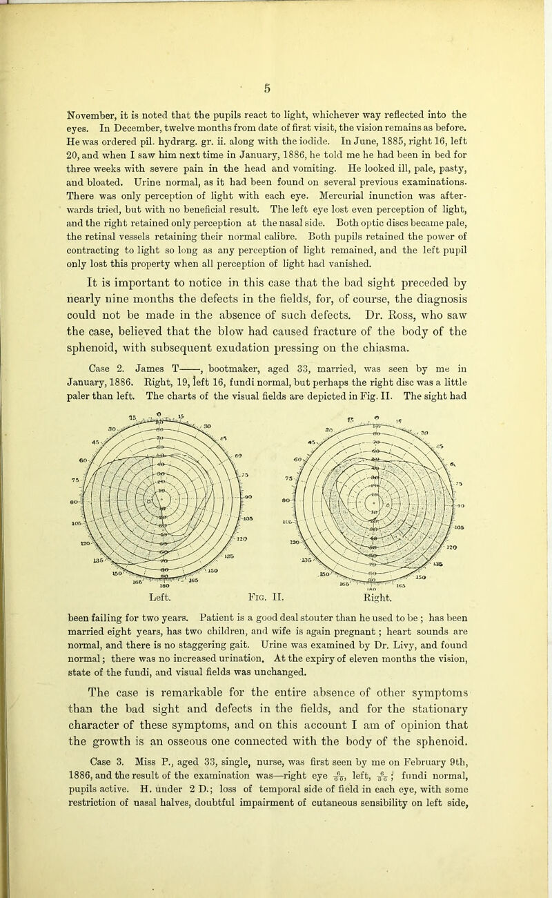 November, it is noted that the pupils react to light, whichever way reflected into the eyes. In December, twelve months from date of first visit, the vision remains as before. He was ordered pil. hydrarg. gr. ii. along with the iodide. In June, 1885, right 16, left 20, and when I saw him next time in January, 1886, he told me he had been in bed for three weeks with severe pain in the head and vomiting. He looked ill, pale, pasty, and bloated. Urine normal, as it had been found on several previous examinations. There was only perception of light with each eye. Mercurial inunction was after- wards tried, but with no beneficial result. The left eye lost even perception of light, and the right retained only perception at the nasal side. Both optic discs became pale, the retinal vessels retaining their normal calibre. Both pupils retained the power of contracting to light so long as any perception of light remained, and the left pupil only lost this property when all perception of light had vanished. It is important to notice in this case that the bad sight preceded by nearly nine months the defects in the fields, for, of course, the diagnosis could not be made in the absence of such defects. Dr. Ross, who saw the case, believed that the blow had caused fracture of the body of the sphenoid, with subsequent exudation pressing on the chiasma. Case 2. James T , bootmaker, aged 33, married, was seen by me in January, 1886. Right, 19, left 16, fundi normal, but perhaps the right disc was a little paler than left. The charts of the visual fields are depicted in Fig. II. The sight had married eight years, has two children, and wife is again pregnant; heart sounds are normal, and there is no staggering gait. Urine was examined by Dr. Livy, and found normal; there was no increased urination. At the expiry of eleven months the vision, state of the fundi, and visual fields was unchanged. The case is remarkable for the entire absence of other symptoms than the bad sight and defects in the fields, and for the stationary character of these symptoms, and on this account I am of opinion that the growth is an osseous one connected with the body of the sphenoid. Case 3. Miss P., aged 33, single, nurse, was first seen by me on February 9th, 1886, and the result of the examination was—right eye left, ; fundi normal, pupils active. H. under 2D.; loss of temporal side of field in each eye, with some restriction of nasal halves, doubtful impairment of cutaneous sensibility on left side,