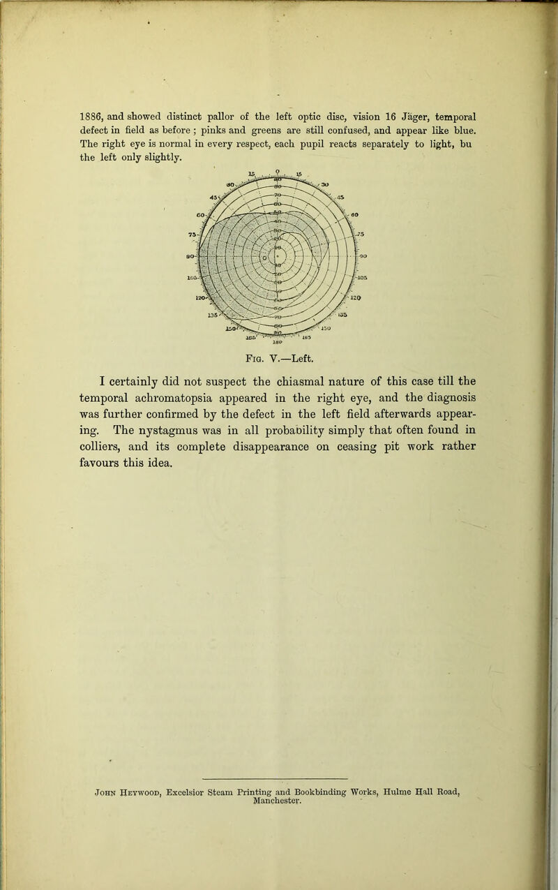 1886, and showed distinct pallor of the left optic disc, vision 16 Jager, temporal defect in field as before ; pinks and greens are still confused, and appear like blue. The right eye is normal in every l’espect, each pupil reacts separately to light, bu the left only slightly. I certainly did not suspect the chiasmal nature of this case till the temporal achromatopsia appeared in the right eye, and the diagnosis was further confirmed by the defect in the left field afterwards appear- ing. The nystagmus was in all probaoility simply that often found in colliers, and its complete disappearance on ceasing pit work rather favours this idea. John Hey wood, Excelsior* Steam Printing and Bookbinding Works, Hulme Hall Road, Manchester.