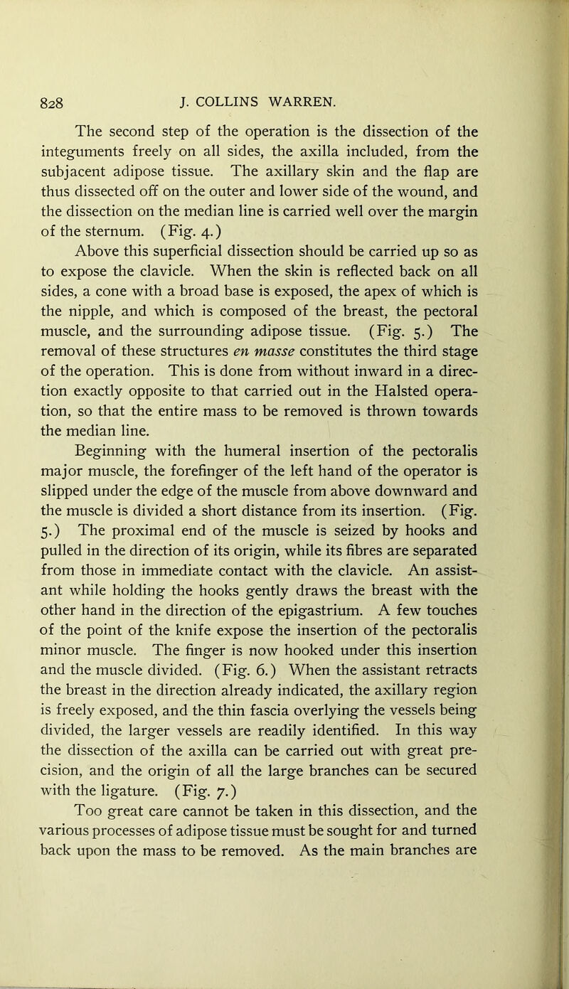 The second step of the operation is the dissection of the integuments freely on all sides, the axilla included, from the subjacent adipose tissue. The axillary skin and the flap are thus dissected off on the outer and lower side of the wound, and the dissection on the median line is carried well over the margin of the sternum. (Fig. 4.) Above this superficial dissection should be carried up so as to expose the clavicle. When the skin is reflected back on all sides, a cone with a broad base is exposed, the apex of which is the nipple, and which is composed of the breast, the pectoral muscle, and the surrounding adipose tissue. (Fig. 5.) The removal of these structures en masse constitutes the third stage of the operation. This is done from without inward in a direc- tion exactly opposite to that carried out in the Halsted opera- tion, so that the entire mass to be removed is thrown towards the median line. Beginning with the humeral insertion of the pectoralis major muscle, the forefinger of the left hand of the operator is slipped under the edge of the muscle from above downward and the muscle is divided a short distance from its insertion. (Fig. 5.) The proximal end of the muscle is seized by hooks and pulled in the direction of its origin, while its fibres are separated from those in immediate contact with the clavicle. An assist- ant while holding the hooks gently draws the breast with the other hand in the direction of the epigastrium. A few touches of the point of the knife expose the insertion of the pectoralis minor muscle. The finger is now hooked under this insertion and the muscle divided. (Fig. 6.) When the assistant retracts the breast in the direction already indicated, the axillary region is freely exposed, and the thin fascia overlying the vessels being divided, the larger vessels are readily identified. In this way the dissection of the axilla can be carried out with great pre- cision, and the origin of all the large branches can be secured with the ligature. (Fig. 7.) Too great care cannot be taken in this dissection, and the various processes of adipose tissue must be sought for and turned back upon the mass to be removed. As the main branches are