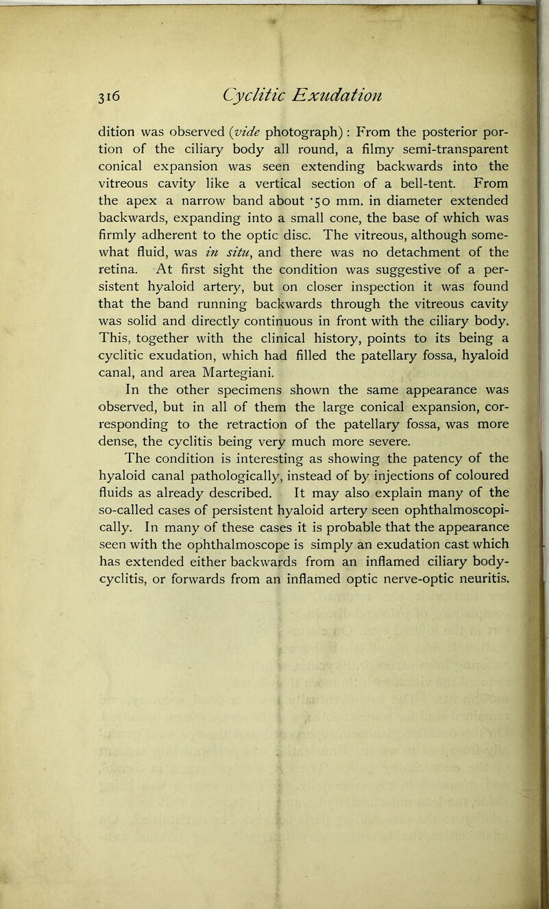 dition was observed {vide photograph) : From the posterior por- tion of the ciliary body all round, a filmy semi-transparent conical expansion was seen extending backwards into the vitreous cavity like a vertical section of a bell-tent. From the apex a narrow band about ’50 mm. in diameter extended backwards, expanding into a small cone, the base of which was firmly adherent to the optic disc. The vitreous, although some- what fluid, was in situ, and there was no detachment of the retina. At first sight the condition was suggestive of a per- sistent hyaloid artery, but on closer inspection it was found that the band running backwards through the vitreous cavity was solid and directly continuous in front with the ciliary body. This, together with the clinical history, points to its being a cyclitic exudation, which had filled the patellary fossa, hyaloid canal, and area Martegiani. In the other specimens shown the same appearance was observed, but in all of them the large conical expansion, cor- responding to the retraction of the patellary fossa, was more dense, the cyclitis being very much more severe. The condition is interesting as showing the patency of the hyaloid canal pathologically, instead of by injections of coloured fluids as already described. It may also explain many of the so-called cases of persistent hyaloid artery seen ophthalmoscopi- cally. In many of these cases it is probable that the appearance seen with the ophthalmoscope is simply an exudation cast which has extended either backwards from an inflamed ciliary body- cyclitis, or forwards from an inflamed optic nerve-optic neuritis.