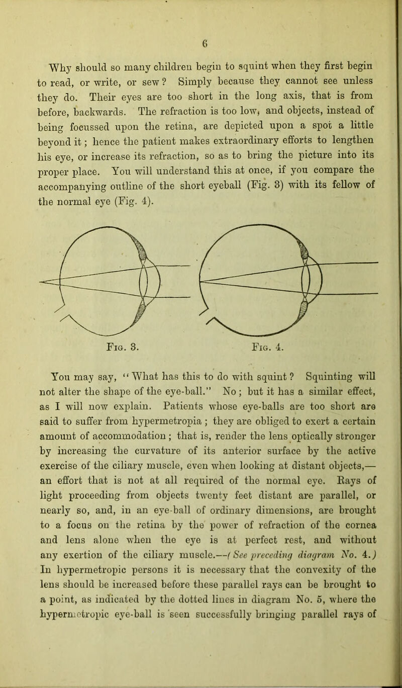 Why should so many childreu begin to squint when they first begin to read, or write, or sew ? Simply because they cannot see unless they do. Their eyes are too short in the long axis, that is from before, backwards. The refraction is too loW) and objects, instead of being focussed upon the retina, are depicted upon a spot a little beyond it; hence the patient makes extraordinary efforts to lengthen his eye, or increase its refraction, so as to bring the picture into its proper place. You will understand this at once, if you compare the accompanying outhne of the short eyeball (Fig. 3) with its fellow of the normal eye (Fig. 4). You may say, “What has this to do with squint ? Squinting wiU not alter the shape of the eye-ball.” No ; but it has a similar effect, as I will now explain. Patients whose eye-balls are too short are said to suffer from hypermetropia ; they are obliged to exert a certain amount of accommodation; that is, render the lens optically stronger by increasing the curvature of its anterior surface by the active exercise of the ciliary muscle, even when looking at distant objects,— an effort that is not at all required of the normal eye. Eays of light proceeding from objects twenty feet distant are parallel, or nearly so, and, in an eye-ball of ordinary dimensions, are brought to a focus on the retina by the power of refraction of the cornea and lens alone when the eye is at perfect rest, and without any exertion of the ciliary muscle.—(See preceding diagram No. 4.j In hypermetropic persons it is necessary that the convexity of the lens should be increased before these parallel rays can be brought to a point, as indicated by the dotted lines in diagram No. 5, where the hypermetropic eye-ball is 'seen successfully bringing parallel rays of