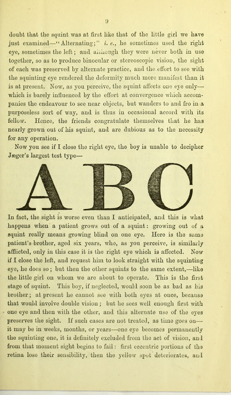 doubt that the squint was at first like that of the httle girl we have just examined—“Alternating;” i. e., he sometimes used the right eye, sometimes the left; and aiuhough they w'ere never both in use together, so as to produce binocular or stereoscopic vision, the sight of each was preserved by alternate practice, and the effort to see with the squinting eye rendered the deformity much more manifest than it is at present. Now, as you perceive, the squint affects one eye only—• which is barely influenced by the effort at convergence which accom- panies the endeavour to see near objects, but wanders to and fro in a purposeless sort of way, and is thus in occasional accord with its fellow. Hence, the friends congratulate themselves that he has nearly grown out of his squint, and are dubious as to the necessity for any operation. Now you see if I close the right eye, the boy is unable to decipher Jsager’s largest test type— In fact, the sight is worse even than I anticipated, and this is what happens when a patient grows out of a squint: growing out of a squint really means growing bhnd on one eye. Here is the same patient’s brother, aged six years, who, as you perceive, is similarly afflicted, only in this case it is the right eye which is affected. Now if I close the left, and request him to look straight with the squinting eye, he does so; but then the other squints to the same extent,—like the little girl on whom we are about to operate. This is the first stage of squint. This boy, if neglected, would soon be as bad as his brother; at present he cannot see with both eyes at once, because that would involve double vision ; but he sees well enough first with one eye and then with the other, and this alternate use of the eyes preserves the sight. If such cases are not treated, as time goes on— it may be in weeks, months, or years—one eye becomes permanently the squinting one, it is definitely excluded from the act of vision, an I from that moment sight begins to fail: first eccentric portions of the retina lose their sensibility, then the yellow spot deteriorates, and