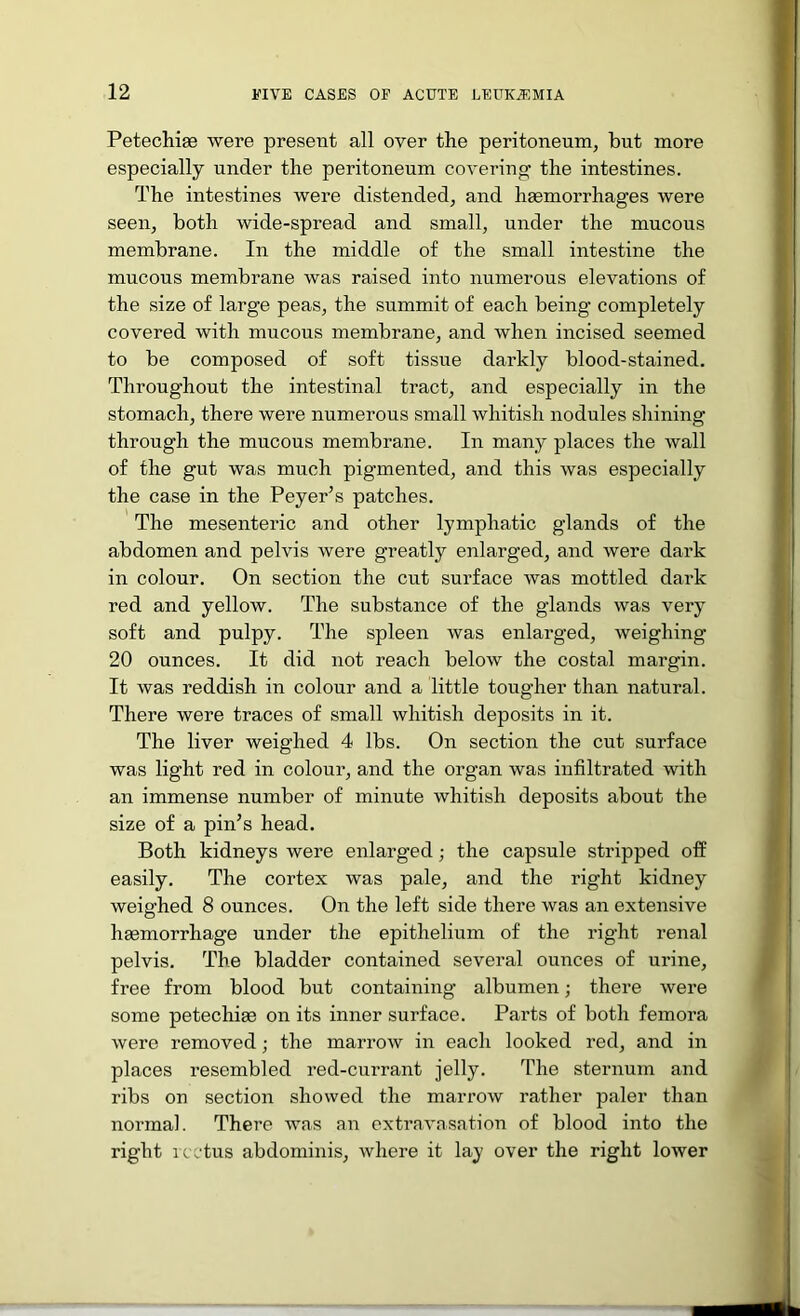Petechige were present all over the peritoneum, but more especially under the peritoneum covering the intestines. The intestines were distended, and hgemorrhages were seen, both wide-spread and small, under the mucous membrane. In the middle of the small intestine the mucous membrane was raised into numerous elevations of the size of large peas, the summit of each being completely covered with mucous membrane, and when incised seemed to be composed of soft tissue darkly blood-stained. Throughout the intestinal tract, and especially in the stomach, there were numerous small whitish nodules shining through the mucous membrane. In many places the wall of the gut was much pigmented, and this was especially the case in the Peyer’s patches. The mesenteric and other lymphatic glands of the abdomen and pelvis were greatly enlarged, and were dark in colour. On section the cut surface was mottled dark red and yellow. The substance of the glands was very soft and pulpy. The spleen was enlarged, weighing 20 ounces. It did not reach below the costal margin. It was reddish in colour and a little tougher than natural. There were traces of small whitish deposits in it. The liver weighed 4 lbs. On section the cut surface was light red in colour, and the organ was infiltrated with an immense number of minute whitish deposits about the size of a pin’s head. Both kidneys were enlarged; the capsule stripped off easily. The cortex was pale, and the right kidney weighed 8 ounces. On the left side there was an extensive haemorrhage under the epithelium of the right renal pelvis. The bladder contained several ounces of urine, free from blood but containing- albumen; there were some petechige on its inner surface. Parts of both femora were removed; the marrow in each looked red, and in places resembled red-currant jelly. The sternum and ribs on section showed the marrow rather paler than normal. There was an extravasation of blood into the right icctus abdominis, where it lay over the right lower