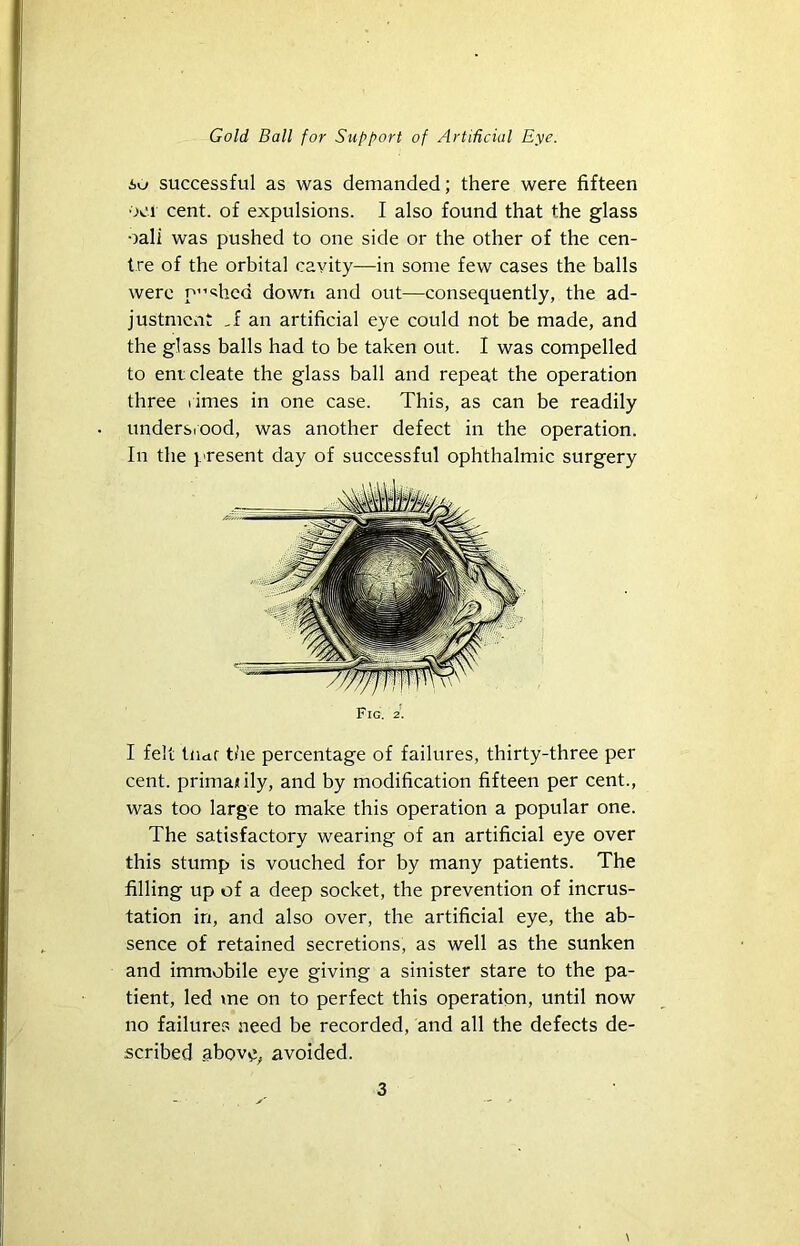 io successful as was demanded; there were fifteen oei cent, of expulsions. I also found that the glass oali was pushed to one side or the other of the cen- tre of the orbital cavity—in some few cases the balls were p”shcd down and out—consequently, the ad- justment ,f an artificial eye could not be made, and the glass balls had to be taken out. I was compelled to entcleate the glass ball and repeat the operation three rimes in one case. This, as can be readily undersiood, was another defect in the operation. In the present day of successful ophthalmic surgery Fig. 2. I felt tiidf the percentage of failures, thirty-three per cent, primaitily, and by modification fifteen per cent., was too large to make this operation a popular one. The satisfactory wearing of an artificial eye over this stump is vouched for by many patients. The filling up of a deep socket, the prevention of incrus- tation in, and also over, the artificial eye, the ab- sence of retained secretions, as well as the sunken and immobile eye giving a sinister stare to the pa- tient, led me on to perfect this operation, until now no failures need be recorded, and all the defects de- scribed abov^;^ avoided.