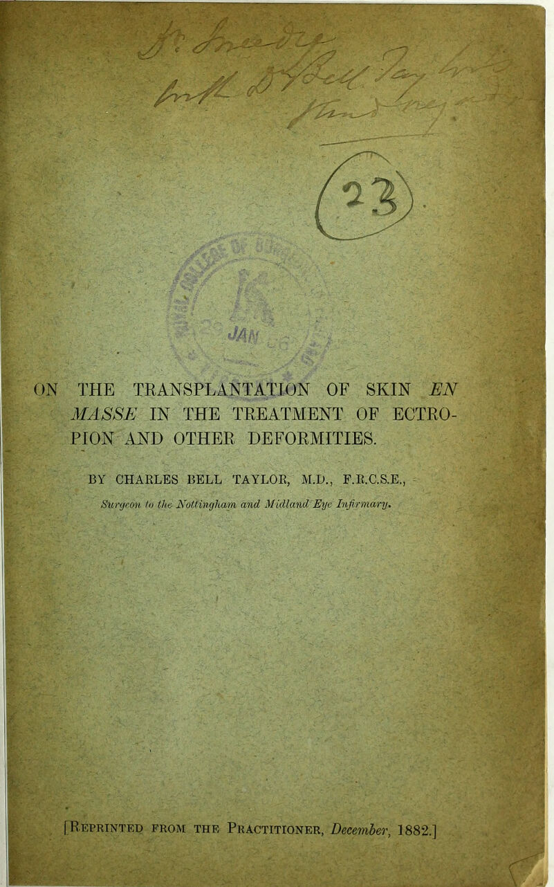 THE TRANSPLANTATION OF SKIN EN MASSE IN THE TREATMENT OF ECTRO- PION AND OTHER DEFORMITIES. BY CHAELES BELL TAYLOE, M.D., F.E.C.S.E., Sxinjeon io tlm Nottingham, and Midland Eye Infirmary. [Reprinted from the Practitioner, December, ]882.]