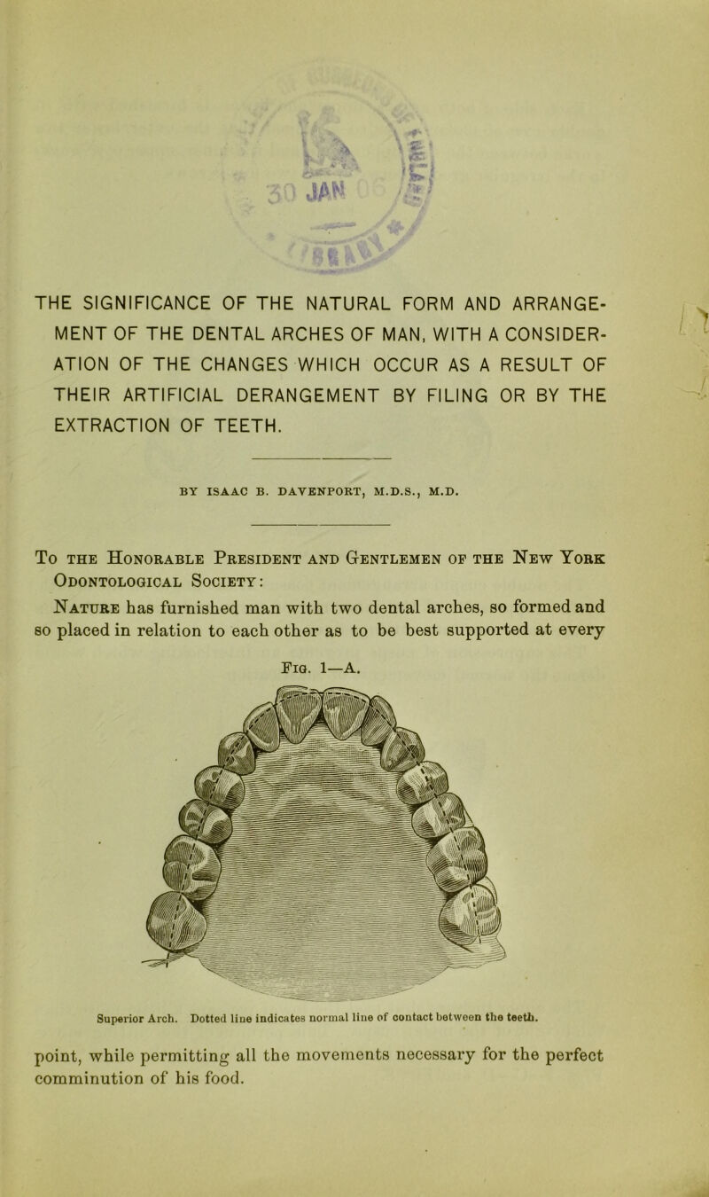 THE SIGNIFICANCE OF THE NATURAL FORM AND ARRANGE- MENT OF THE DENTAL ARCHES OF MAN, WITH A CONSIDER- ATION OF THE CHANGES WHICH OCCUR AS A RESULT OF THEIR ARTIFICIAL DERANGEMENT BY FILING OR BY THE EXTRACTION OF TEETH. BY ISAAC B. DAVENPORT, M.D.S., M.D. To the Honorable President and Gentlemen of the Hew York Odontological Society: Nature has furnished man with two dental arches, so formed and so placed in relation to each other as to be best supported at every Fig. 1—A. Superior Arch. Dotted line indicates normal line of contact between the teeth. point, while permitting all the movements necessary for the perfect comminution of his food.