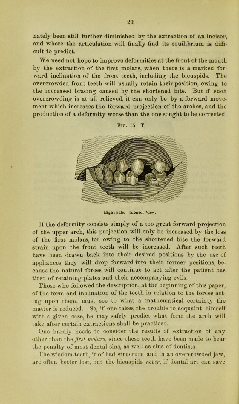 nately been still further diminished by the extraction of an incisor, and where the articulation will finally find its equilibrium is diffi- cult to predict. We need not hope to improve deformities at the front of the mouth by the extraction of the first molars, when there is a marked for- ward inclination of the front teeth, including the bicuspids. The overcrowded front teeth will usually retain their position, owing to the increased bracing caused by the shortened bite. But if such overcrowding is at all relieved, it can only be by a forward move- ment which increases the forward projection of the arches, and the production of a deformity worse than the one sought to be corrected. Fig. 15—T. Bight Side. Interior View. If the deformity consists simply of a too great forward projection of the upper arch, this projection will only be increased by the loss of the first molars, for owing to the shortened bite the forward strain upon the front teeth will be increased. After such teeth have been drawn back into their desired positions by the use of appliances they will drop forward into their former positions, be- cause the natural forces will continue to act after the patient has tired of retaining plates and their accompanying evils. Those who followed the description, at the beginning of this paper, of the form and inclination of the teeth in relation to the forces act- ing upon them, must see to what a mathematical certainty the matter is reduced. So, if one takes the trouble to acquaint himself with a given case, he may safely predict what form the arch will take after certain extractions shall be practiced. One hardly needs to consider the results of extraction of any other than the first molars, since these teeth have been made to bear the penalty of most dental sins, as well as sins of dentists. The wisdom-teeth, if of bad structure and in an overcrowded jaw, are often better lost, but the bicuspids never, if dental art can save