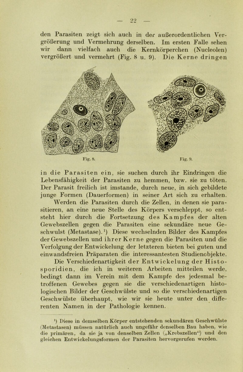 größerung und Vermehrung derselben. Im ersten Falle sehen wir dann vielfach auch die Kernkörperchen (Nucleolen) vergrößert und vermehrt (Fig. 8 u. 9). Die Kerne dringen Fig. 8. Fig. 9. in die Parasiten ein, sie suchen durch ihr Eindringen die Lebensfähigkeit der Parasiten zu hemmen, bzw. sie zu töten. Der Parasit freilich ist imstande, durch neue, in sich gebildete junge Formen (Dauerformen) in seiner Art sich zu erhalten. Werden die Parasiten durch die Zellen, in denen sie para- sitären, an eine neue Stelle des Körpers verschleppt, so ent- steht hier durch die Fortsetzung des Kampfes der alten Gewebszellen gegen die Parasiten eine sekundäre neue Ge- schwulst (Metastase).1) Diese wechselnden Bilder des Kampfes der Gewebszellen und ihrer Kerne gegen die Parasiten und die Verfolgung der Entwickelung der letzteren bieten bei guten und einwandsfreien Präparaten die interessantesten Studienobjekte. Die Verschiedenartigkeit der Entwickelung der Histo- sporidien, die ich in weiteren Arbeiten mitteilen werde, bedingt dann im Verein mit dem Kampfe des jedesmal be- troffenen Gewebes gegen sie die verschiedenartigen histo- logischen Bilder der Geschwülste und so die verschiedenartigen Geschwülste überhaupt, wie wir sie heute unter den diffe- renten Namen in der Pathologie kennen. J) Diese in demselben Körper entstehenden sekundären Geschwülste (Metastasen) müssen natürlich auch ungefähr denselben Bau haben, wie die primären, da sie ja von denselben Zellen („Krebszellen“) und den gleichen Entwickelungsformen der Parasiten hervorgerufen werden.