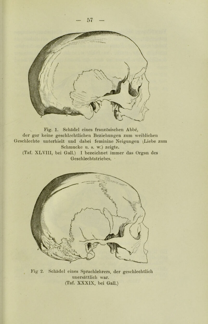 Fig. 1. Schädel eines französischen Abbe, der gar keine geschlechtlichen Beziehungen znm weiblichen Geschlechte unterhielt nnd dabei feminine Neigungen i^Liebe zum Schmucke n. s. w.) zeigte. (Taf. XLVIII, bei Gail.) I bezeichnet immer das Organ des Geschlechtstriebes. • Fig 2. Schädel eines Sprachlehrers, der geschlechtlich unersättlich war. (Taf. XXXIX, bei Gail.)