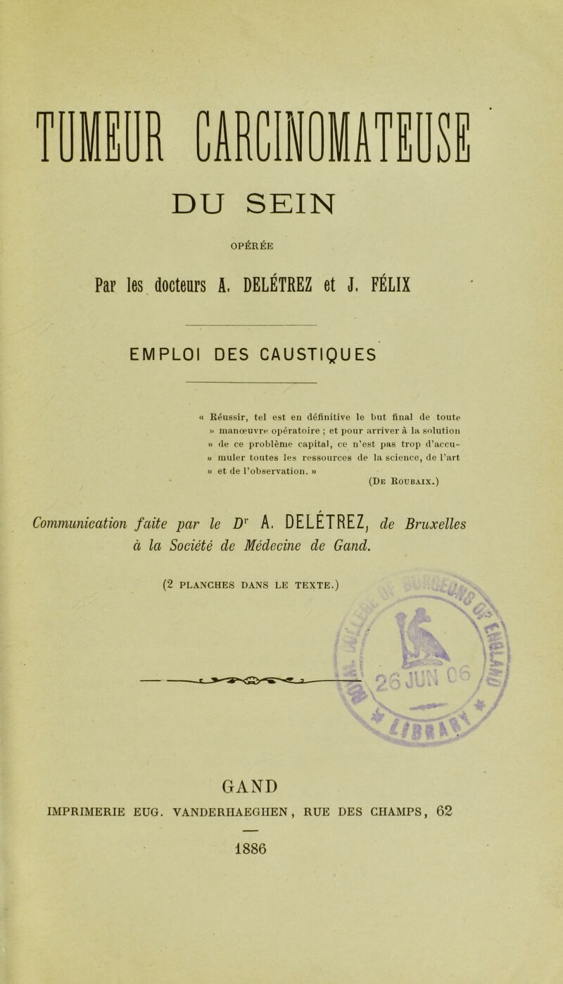 > ■ 11 (11 Ij M tt uni Wm J un IIAI ■ 1 !j uül DU SEIN OPÉRÉE Par les docteurs A, DELÉTREZ et J. FÉLIX EMPLOI DES CAUSTIQUES « Réussir, tel est en définitive le but final de toute » manœuvre opératoire ; et pour arriver à la solution M de ce problème capital, ce n’est pas trop d’accu- « muter toutes les ressources de la science, de l’art » et de l’observation. » (De Roubaix.) Communication faite par le D’’ A. DELETREZ^ de Bruxelles à la Société de Médecine de Gand. (2 PLANCHES DANS LE TEXTE.) GAND IMPRIMERIE EUG. VANDERHAEGIIEN, RUE DES CHAMPS, 62 1886