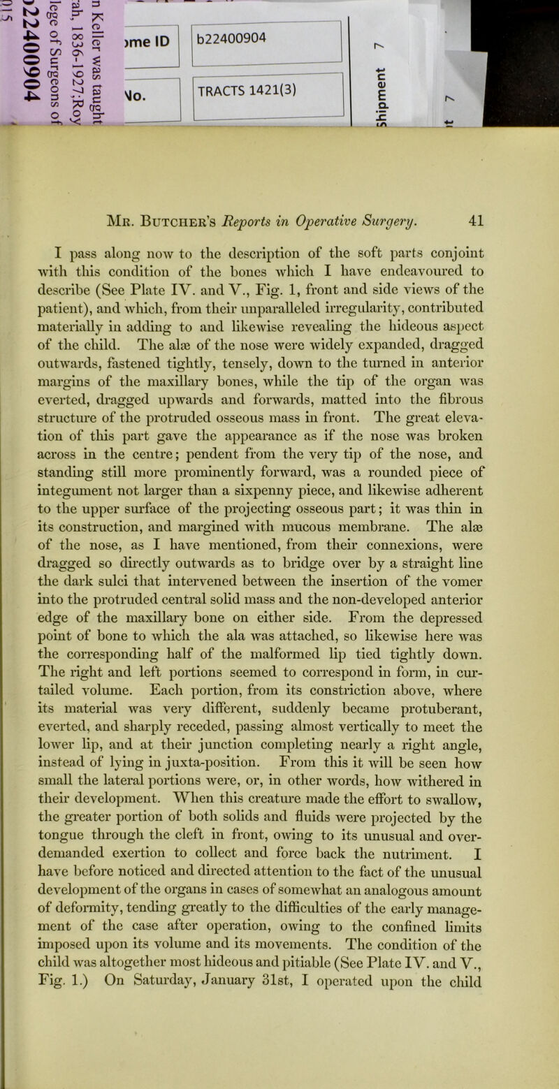 ^1 r a 3 CD CTQ CD VO 03 cr C/5 C *1 CTQ CD O 3 co CD O no — OO OJ I K> O o CD -t P CO P c CTQ 3* >me ID b22400904 rv Mo. TRACTS 1421(3) c <D E Q. ir\ Mr. Butcher’s Reports in Operative Surgery. 41 I pass along now to the description of the soft parts conjoint with this condition of the bones which I have endeavoured to describe (See Plate IV. and V., Fig. 1, front and side views of the patient), and which, from their unparalleled irregularity, contributed materially in adding to and likewise revealing the hideous aspect of the child. The ake of the nose were widely expanded, dragged outwards, fastened tightly, tensely, down to the turned in anterior margins of the maxillary bones, while the tip of the organ was everted, dragged upwards and forwards, matted into the fibrous structure of the protruded osseous mass in front. The great eleva- tion of this part gave the appearance as if the nose was broken across in the centre; pendent from the very tip of the nose, and standing still more prominently forward, was a rounded piece of integument not larger than a sixpenny piece, and likewise adherent to the upper surface of the projecting osseous part; it was thin in its construction, and margined with mucous membrane. The ala3 of the nose, as I have mentioned, from their connexions, were dragged so directly outwards as to bridge over by a straight line the dark sulci that intervened between the insertion of the vomer into the protruded central solid mass and the non-developed anterior edge of the maxillary bone on either side. From the depressed point of bone to which the ala was attached, so likewise here was the corresponding half of the malformed lip tied tightly down. The right and left portions seemed to correspond in form, in cur- tailed volume. Each portion, from its constriction above, where its material was very different, suddenly became protuberant, everted, and sharply receded, passing almost vertically to meet the lower lip, and at their junction completing nearly a right angle, instead of lying in juxta-position. From this it will be seen how small the lateral portions were, or, in other words, how withered in their development. When this creature made the effort to swallow, the greater portion of both solids and fluids were projected by the tongue through the cleft in front, owing to its unusual and over- demanded exertion to collect and force back the nutriment. I have before noticed and directed attention to the fact of the unusual development of the organs in cases of somewhat an analogous amount of deformity, tending greatly to the difficulties of the early manage- ment of the case after operation, owing to the confined limits imposed upon its volume and its movements. The condition of the child was altogether most hideous and pitiable (See Plate IV. and V., Fig. 1.) On Saturday, January 31st, I operated upon the child