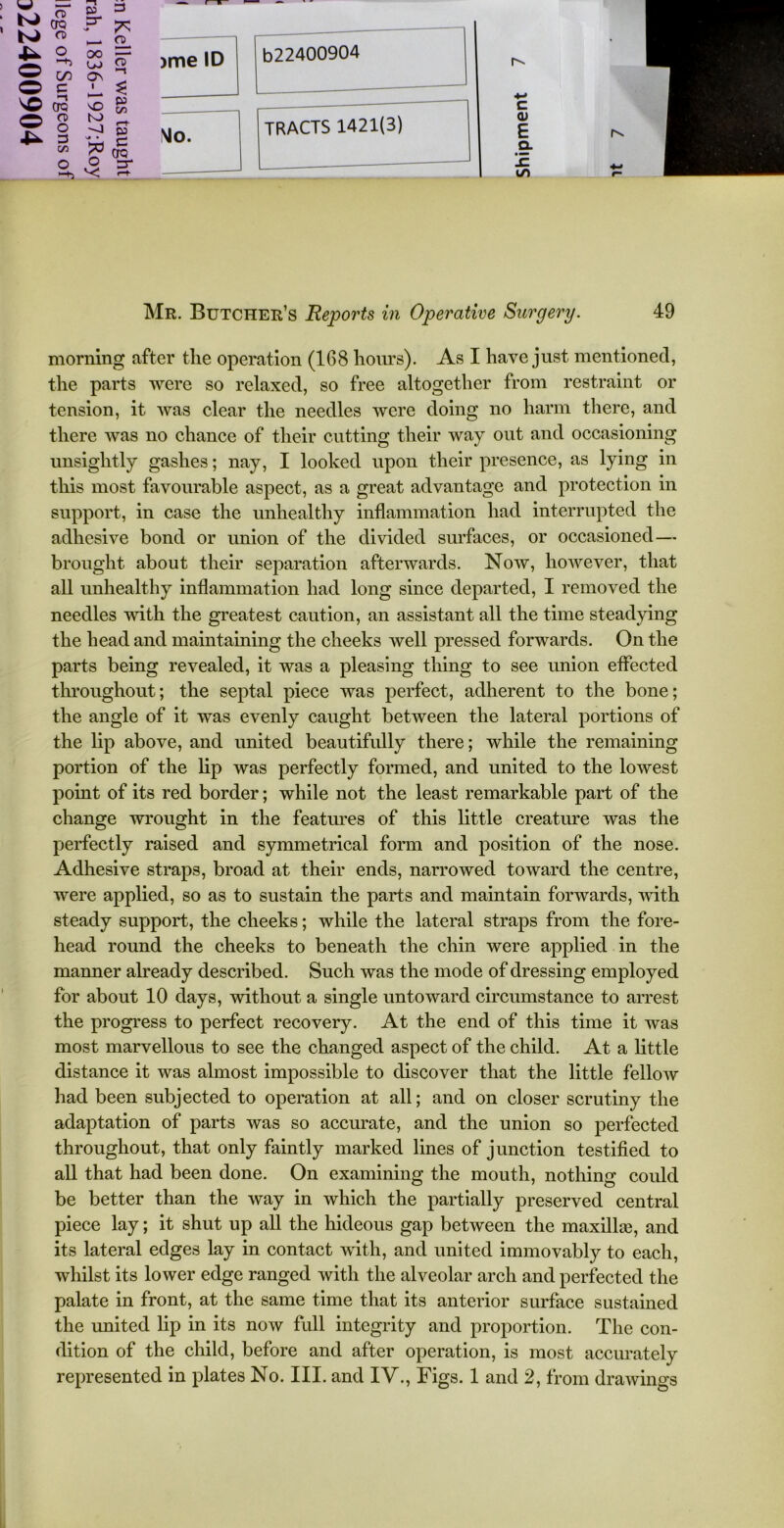 w — & a> o E VO CTQ o S 4- 3 C/3 o “b £5 3 P* ^ 2- 00 £r uj s> £ * s ! '-j a c CTQ O ;r v; s- >me ID Mo. b22400904 TRACTS 1421(3) c <D E Q- Mr. Butcher’s Reports in Operative Surgery. 49 morning after the operation (168 hours). As I have just mentioned, the parts were so relaxed, so free altogether from restraint or tension, it was clear the needles were doing no harm there, and there was no chance of their cutting their way out and occasioning unsightly gashes; nay, I looked upon their presence, as lying in this most favourable aspect, as a great advantage and protection in support, in case the unhealthy inflammation had interrupted the adhesive bond or union of the divided surfaces, or occasioned — brought about their separation afterwards. Now, however, that all unhealthy inflammation had long since departed, I removed the needles with the greatest caution, an assistant all the time steadying the head and maintaining the cheeks well pressed forwards. On the parts being revealed, it was a pleasing thing to see union effected throughout; the septal piece was perfect, adherent to the bone; the angle of it was evenly caught between the lateral portions of the lip above, and united beautifully there; while the remaining portion of the lip was perfectly formed, and united to the lowest point of its red border; while not the least remarkable part of the change wrought in the features of this little creature was the perfectly raised and symmetrical form and position of the nose. Adhesive straps, broad at their ends, narrowed toward the centre, were applied, so as to sustain the parts and maintain forwards, with steady support, the cheeks; while the lateral straps from the fore- head round the cheeks to beneath the chin were applied in the manner already described. Such was the mode of dressing employed for about 10 days, without a single untoward circumstance to arrest the progress to perfect recovery. At the end of this time it was most marvellous to see the changed aspect of the child. At a little distance it was almost impossible to discover that the little fellow had been subjected to operation at all; and on closer scrutiny the adaptation of parts was so accurate, and the union so perfected throughout, that only faintly marked lines of junction testified to all that had been done. On examining the mouth, nothing could be better than the way in which the partially preserved central piece lay; it shut up all the hideous gap between the maxilla?, and its lateral edges lay in contact with, and united immovably to each, whilst its lower edge ranged with the alveolar arch and perfected the palate in front, at the same time that its anterior surface sustained the united lip in its now full integrity and proportion. The con- dition of the child, before and after operation, is most accurately