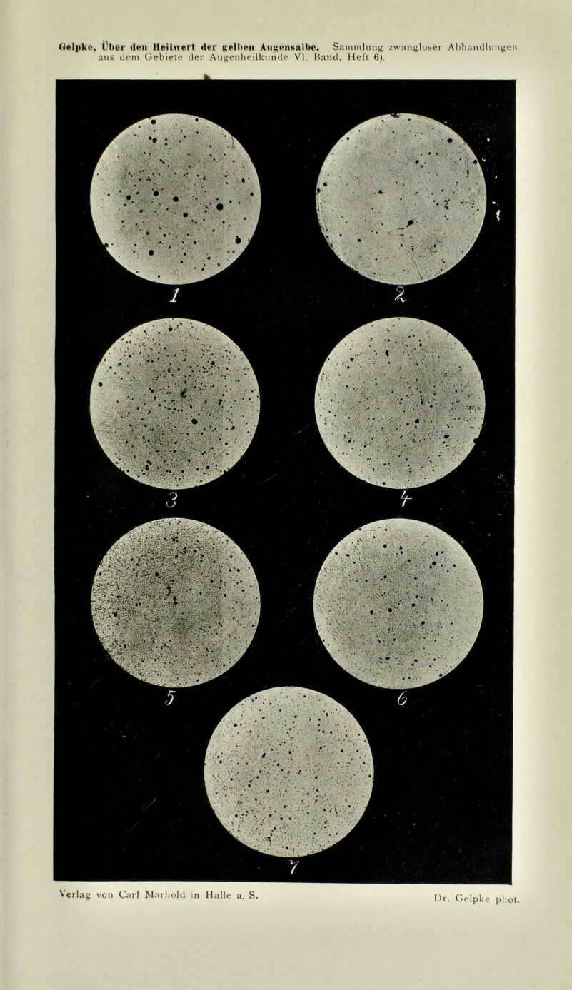 («elpke. Über <leii Heilnei't «1er gelben Aukens»Ibc. Sammhinp; zwangloser Al)tiandlimgeii aus dem Gebiete der Augenheilkunde VI. Hand, lieft G). Verlag von Carl Mtirhold in Halle a. S L)r. Gelpke pliot