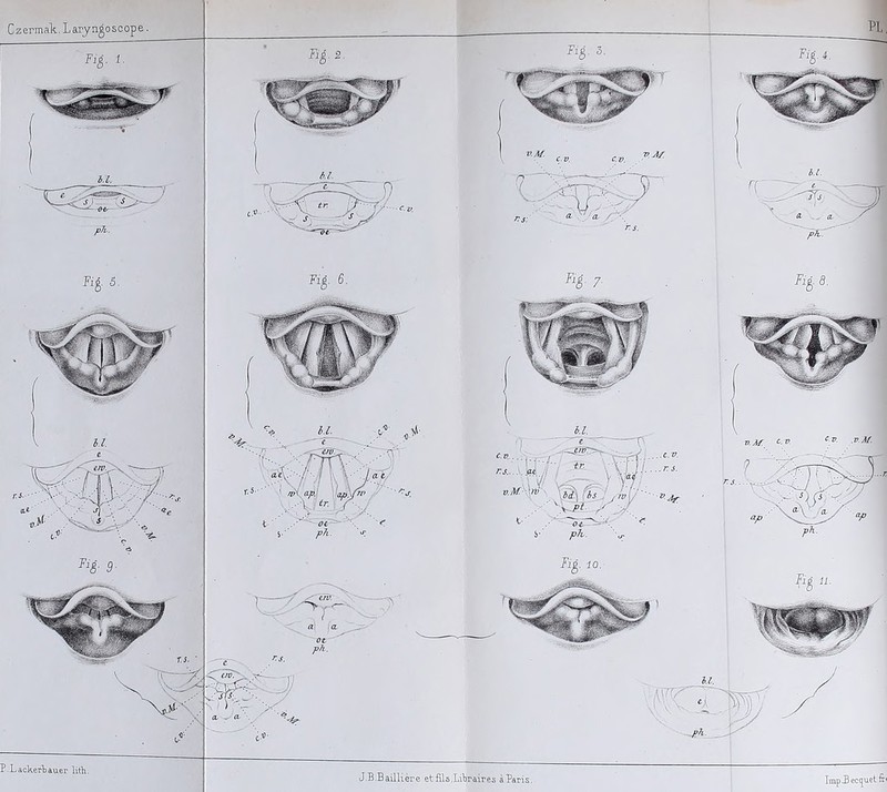 P.Lackerbauer lith. J.B Baillière et fils,Libraires à Paris TmpJBeccjuet ft<