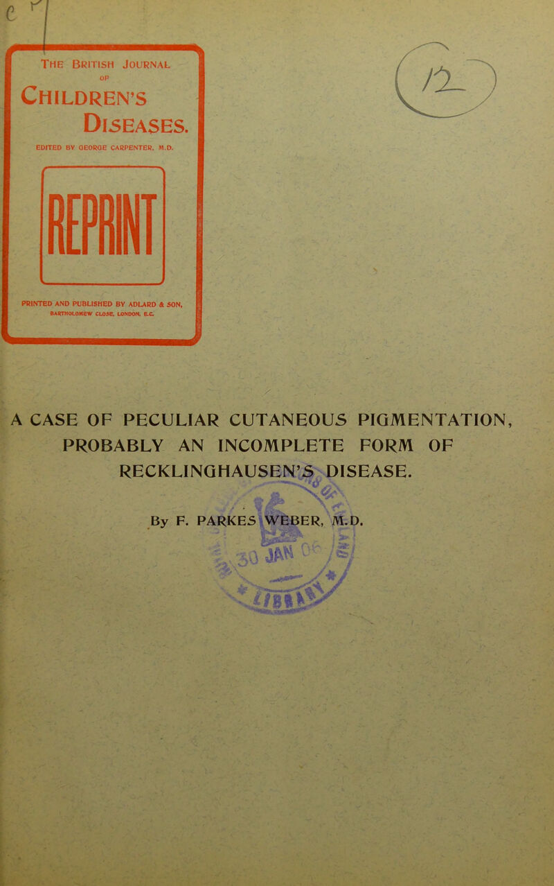 The British Journal OP Childrens Diseases. EDITED BY OEOROE CARPENTER. M.D. r \ A CASE OF PECULIAR CUTANEOUS PIGMENTATION, PROBABLY AN INCOMPLETE FORM OF RECKLINGHAUSEN’S DISEASE. By F. PARKES WEBER, M.D. V * ’ t 