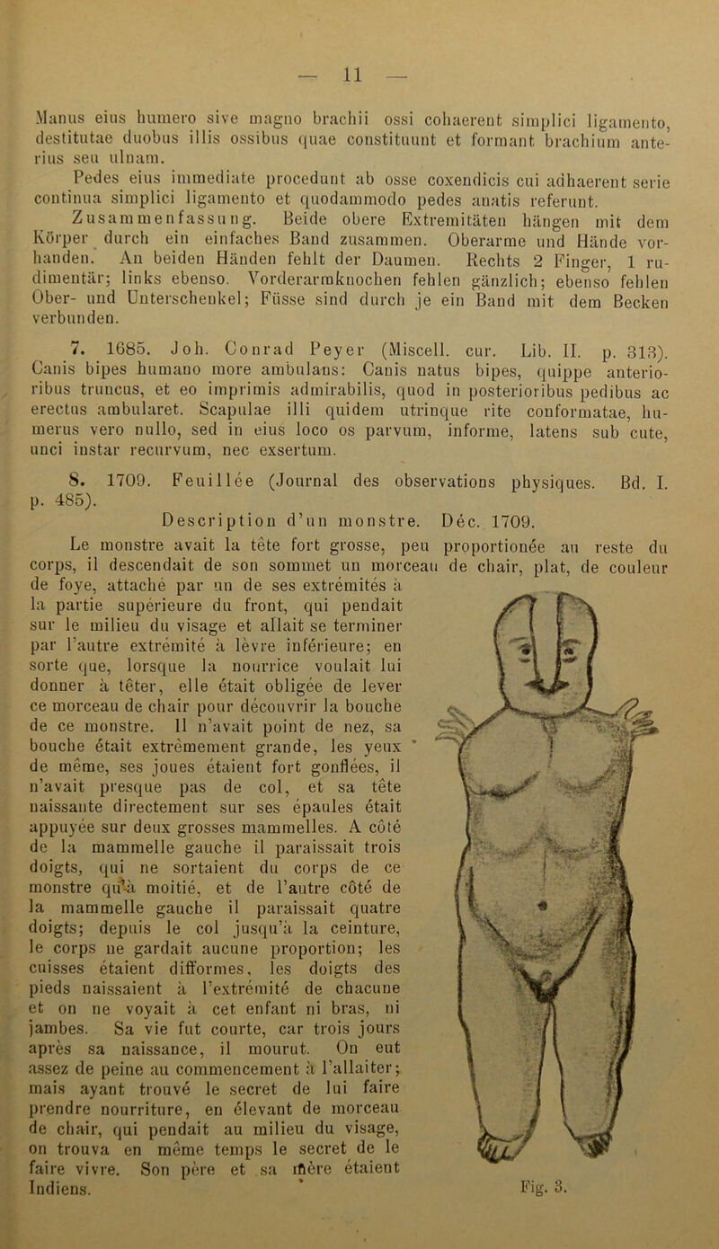 Manns eins Immero sive magno brachii ossi cohaerent siinplici ligamento, destitutae duobns illis ossibus {j(uae constitiuint et formant brachium ante- rius seu ulnam. Pedes eins immediate procedunt ab osse coxendicis cui adhaerent serie Continua siinplici ligamento et quodammoclo pedes anatis refenint. Zusammenfassung. Beide obere Extremitäten hängen mit dem Körper durch ein einfaches Band zusammen. Oberarme und Hände vor- handen. All beiden Händen fehlt der Daumen. Rechts 2 Finger, 1 ru- dimentär; links ebenso. Vorderarraknochen fehlen gänzlich; ebenso fehlen Ober- und Unterschenkel; Füsse sind durch je ein Band mit dem Becken verbunden. 7. 1685. Joh. Conrad Peyer (Miscell. cur. Lib. II. p. 318). Canis bipes humano raore ambulaus: Canis natus bipes, quippe anterio- ribus truncus, et eo imprimis admirabilis, quod in posterioribiis pedibus ac erectus ambularet. Scapulae illi quidem utrinque rite conformatae, hu- merus vero nullo, sed in eins loco os parvum, informe, latens sub cute, unci instar recurvum, nec exsertum. 8. 1709. Feuillee (Journal des observations physiques. Bd. I. p. 485). Description d’iin monstre. Dec. 1709. Le monstre avait la tete fort grosse, peu proportionee au reste du corps, il descendait de son sommet un morceau de chair, plat, de couleur de foye, attache par un de ses extremites ä la partie superieure du front, qui pendait sur le milieu du visage et allait se terminer par l’autre extremite ä levre inferieure; en Sorte que, lorsque la nourrice voulait lui donner ä teter, eile etait obligee de lever ce morceau de chair pour decouvrir la bouche de ce monstre. 11 n’avait point de nez, sa bouche etait extremeraent grande, les yeux ’ de merae, ses joues etaient fort gonflees, il n’avait presque pas de col, et sa tete naissante directement sur ses epaules etait appuyee sur deux grosses mammelles. A cote de la mammelle gauche il paraissait trois doigts, qui ne sortaient du corps de ce monstre qiAä moitie, et de l’autre cöte de la mammelle gauche il paraissait quatre doigts; depuis le col jusqu’k la ceinture, le corps ne gardait aucune proportion; les cuisses etaient dilformes, les doigts des pieds naissaient ä Textremite de chacune et on ne voyait ä cet enfant ni bras, ui jambes. Sa vie fut courte, car trois Jours apres sa naissance, il mourut. On eut assez de peine au commenceraent a l’allaiter; mais ayant trouve le secret de lui faire prendre nourriture, en 41evant de morceau de chair, qui pendait au milieu du visage, on trouva en meme temps le secret de le faire vivre. Son pere et sa ifi6re etaient Indiens.