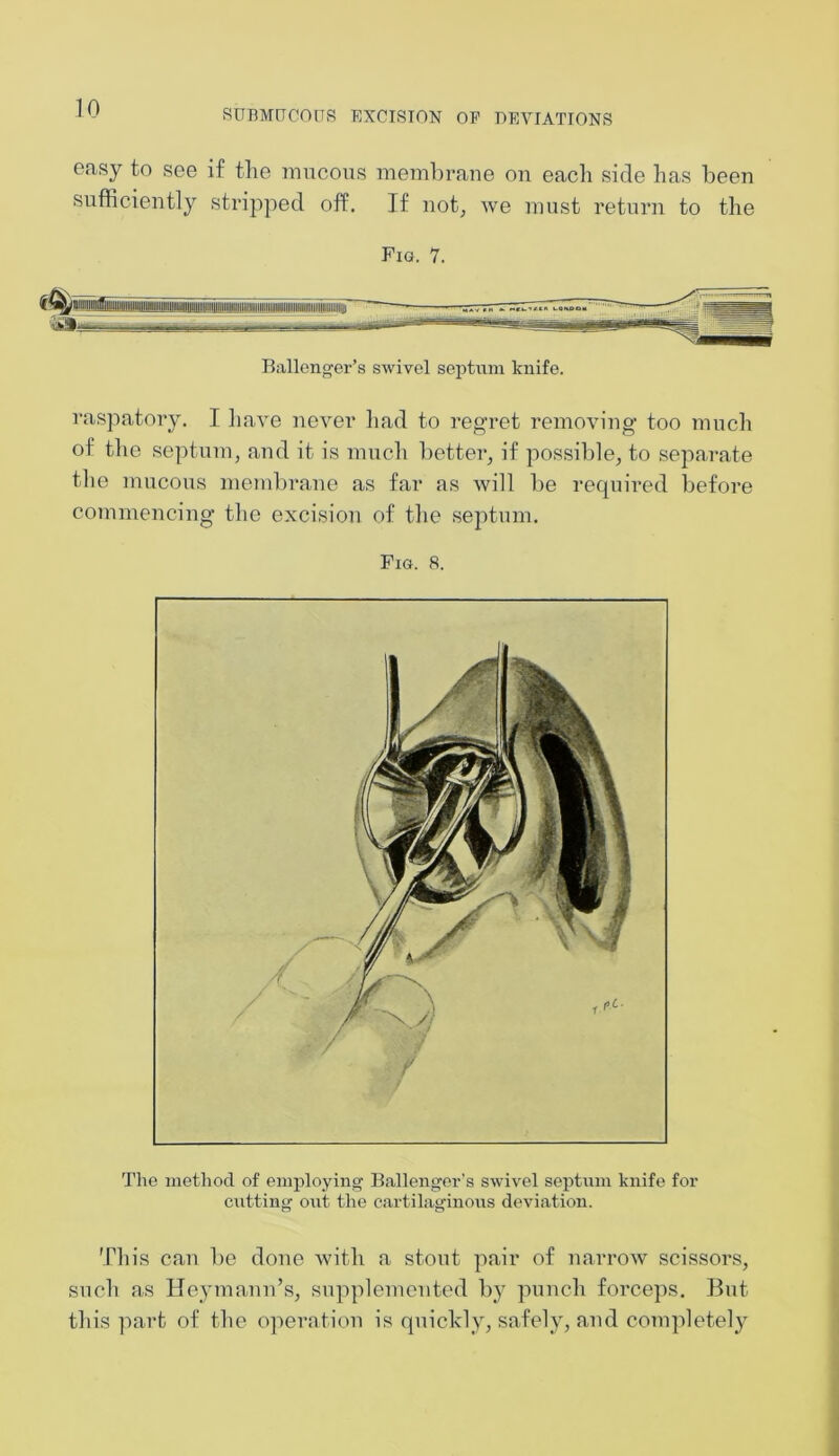 easy to see if the mucous membrane on each side has been sufficiently stripped off. If not, we must return to the Fig. 7. Ballenger’s swivel septum knife. raspatory. I have never had to regret removing too much of the septum, and it is much better, if possible, to separate the mucous membrane as far as will be required before commencing the excision of the septum. Fig. 8. The method of employing Ballenger’s swivel septum knife for cutting out- the cartilaginous deviation. This can be done with a stout pair of narrow scissors, such as Heymann’s, supplemented by punch forceps. But- this part of the operation is quickly, safely, and completely