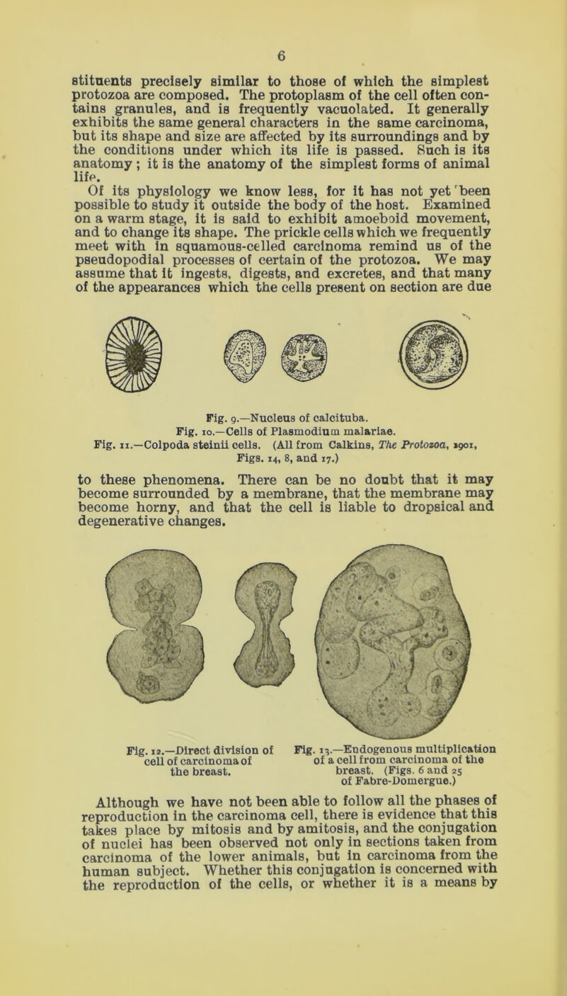 stituents precisely similar to those of which the simplest protozoa are composed. The protoplasm of the cell often con- tains granules, and is frequently vacuolated. It generally exhibits the same general characters in the same carcinoma, but its shape and size are affected by its surroundings and by the conditions under which its life is passed. Such is its anatomy ; it is the anatomy of the simplest forms of animal life. Of its physiology we know less, for it has not yet 'been possible to study it outside the body of the host. Examined on a warm stage, it is said to exhibit amoeboid movement, and to change its shape. The prickle cells which we frequently meet with In squamous-celled carcinoma remind us of the pseudopodial processes of certain of the protozoa. We may assume that It ingests, digests, and excretes, and that many of the appearances which the cells present on section are due Fig. 9.—Nucleus of calcituba. Fig. 10.—Cells of Plasmodium malariae. Fig. 11.—Colpoda steinii cells. (All from Calkins, The Protozoa, 1901, Figs. 14, 8, and 17.) to these phenomena. There can be no doubt that it may become surrounded by a membrane, that the membrane may become horny, and that the cell is liable to dropsical and degenerative changes. Fig. 12.—Direct division of Fig. 13.—Endogenous multiplication cell of carcinoma of of a cell from carcinoma of the the breast. breast. (Figs. 6 and 25 of Fabre-Domergue.) Although we have not been able to follow all the phases of reproduction in the carcinoma cell, there is evidence that this takes place by mitosis and by amitosis, and the conjugation of nuclei has been observed not only in sections taken from carcinoma of the lower animals, but in carcinoma from the human subject. Whether this conjugation is concerned with the reproduction of the cells, or whether it is a means by