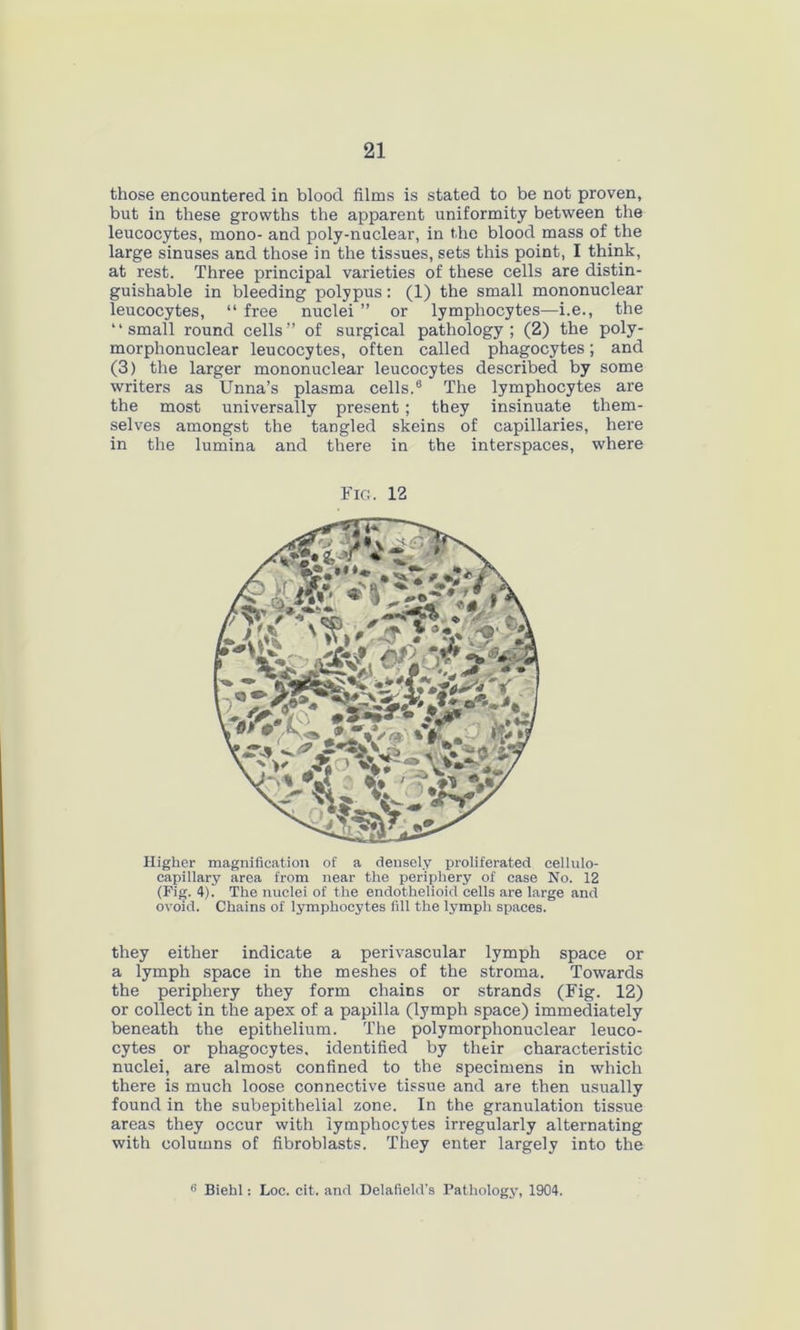 those encountered in blood films is stated to be not proven, but in these growths the apparent uniformity between the leucocytes, mono- and poly-nuclear, in the blood mass of.the large sinuses and those in the tissues, sets this point, I think, at rest. Three principal varieties of these cells are distin- guishable in bleeding polypus: (1) the small mononuclear leucocytes, “ free nuclei ” or lymphocytes—i.e., the “small round cells” of surgical pathology; (2) the poly- morphonuclear leucocytes, often called phagocytes; and (3) the larger mononuclear leucocytes described by some writers as Unna’s plasma cells.6 The lymphocytes are the most universally present; they insinuate them- selves amongst the tangled skeins of capillaries, here in the lumina and there in the interspaces, where Fig. 12 Higher magnification of a densely proliferated cellulo- capillary area from near the periphery of case No. 12 (Fig. 4). The nuclei of the endothelioicl cells are large and ovoid. Chains of lymphocytes fill the lymph spaces. they either indicate a perivascular lymph space or a lymph space in the meshes of the stroma. Towards the periphery they form chains or strands (Fig. 12) or collect in the apex of a papilla (lymph space) immediately beneath the epithelium. The polymorphonuclear leuco- cytes or phagocytes, identified by their characteristic nuclei, are almost confined to the specimens in which there is much loose connective tissue and are then usually found in the subepithelial zone. In the granulation tissue areas they occur with lymphocytes irregularly alternating with columns of fibroblasts. They enter largely into the 6 Biehl: Loc. cit. and Delafield's Pathology, 1904.