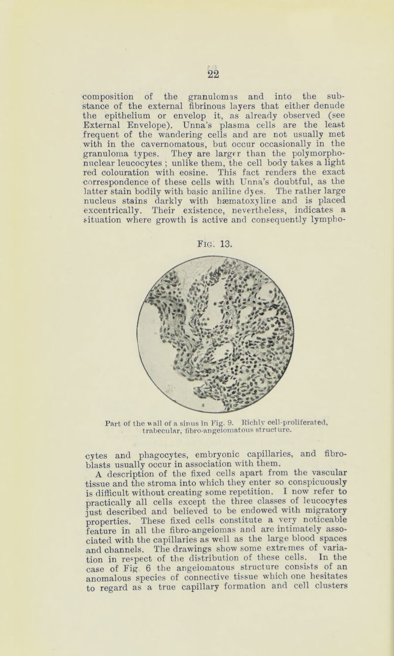 composition of the granulomas and into the sub- stance of the external fibrinous layers that either denude the epithelium or envelop it, as already observed (see External Envelope). Unna’s plasma cells are the least frequent of the wandering cells and are not usually met with in the cavernomatous, but occur occasionally in the granuloma types. They are larger than the polymorpho- nuclear leucocytes ; unlike them, the cell body takes a light red colouration with eosine. This fact renders the exact correspondence of these cells with Unna’s doubtful, as the latter stain bodily with basic aniline dyes. The rather large nucleus stains darkly with hasmatoxyline and is placed excentrically. Their existence, nevertheless, indicates a situation where growth is active and consequently lympho- Fig. 13. Part of the wall of a sinus in Fig. 9. Richly cell-proliferated, trabecular, libro-angeioinatous structure. cytes and phagocytes, embryonic capillaries, and fibro- blasts usually occur in association with them. A description of the fixed cells apart from the vascular tissue and the stroma into which they enter so conspicuously is difficult without creating some repetition. I now refer to practically all cells except the three classes of leucocytes just described and believed to be endowed with migratory properties. These fixed cells constitute a very noticeable feature in all the fibro-angeiomas and are intimately asso- ciated with the capillaries as well as the large blood spaces and channels. The drawings show some extremes of varia- tion in respect of the distribution of these cells. In the case of Fig. 6 the angeiomatous structure consists of an anomalous species of connective tissue which one hesitates to regard as a true capillary formation and cell clusters