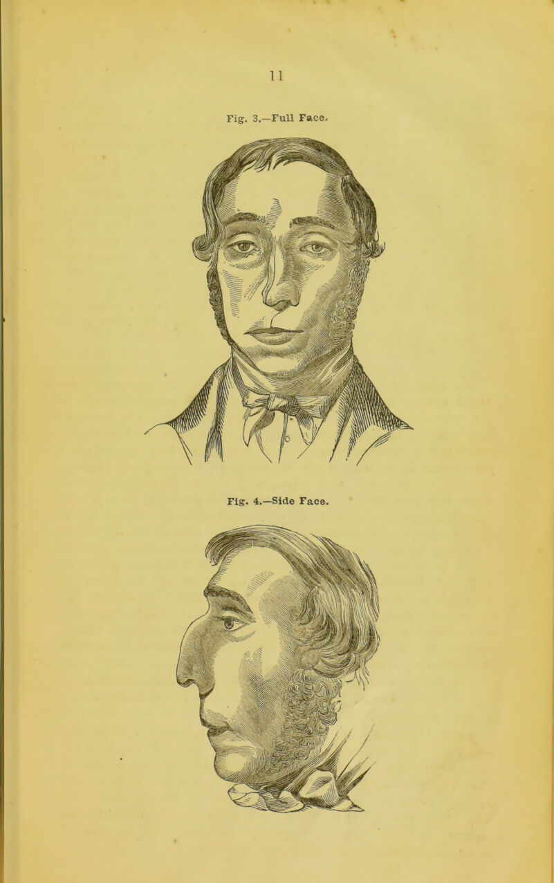 Fig. 3.—Full Face.. Fig. 4.—Side Face.