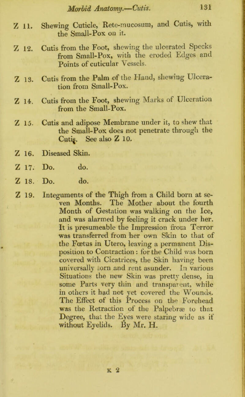 7 ii. Shewing Cuticle, Rete-mucosum, and Cutis, with the Small-Pox on it. Z 12. Cutis from the Foot, shewing the ulcerated Specks from Small-Pox, with the eroded Edges and Points of cuticular Vessels. Z 13. Cutis from the Palm of the Eland, shewing Ulcera- tion from Small-Pox. Z 14. Cutis from the Foot, shewing Marks of Ulceration from the Small-Pox. Z 15. Cutis and adipose Membrane under it, to shew that the Small-Pox does not penetrate through the Cuti^. See also Z 10. Z 16. Diseased Skin. Z 17. Do. do. Z 18. Do. do. Z 19. Integuments of the Thigh from a Child born at se- ven Months. The Mother about the fourth Month of Gestation was walking on the Ice, and was alarmed by feeling it crack under her. It is presumeable the Impression from Terror was transferred from her own Skin to that of the Foetus in Utero, leaving a permanent Dis- position to Contraction : for the Child was born covered with Cicatrices, the Skin having been universally torn and rent asunder. In various Situations the new Skin was pretty dense, in some Parts very thin and transparent, while in others it had not yet covered the Wounds. The Effect of this Process on the Forehead was the Retraction of the Palpebrse to that Degree, that the Eyes were staring wide as if without Eyelids. By Mr. H. K 2