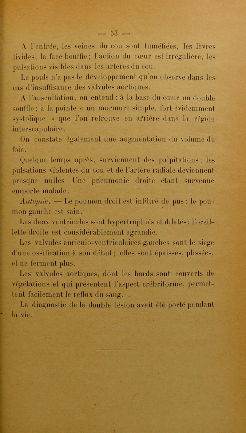 A l’entrée, les veines du cou sont tuméfiées, les lèvres livides, la face bouille; l’action du cœur est irrégulière, les pulsations visibles dans les artères du cou. Le pouls n'a pas le développement qu’on observe dans les cas d’insuffisance des valvules aortiques. A l’auscultation, on entend : à la base du cœur un double souffle; à la pointe « un murmure simple, fort évidemment systolique » que l’on retrouve en arrière dans la région interscapulaire. On constate également une augmentation du volume du foie. Quelque temps après, surviennent des palpitations ; les pulsations violentes du cou et de l’artère radiale deviennent presque nulles Une pneumonie droite étant survenue emporte malade. Autopsie. — Le poumon droit est infiltré de pus; le pou- mon gauche est sain. Les deux ventricules sont hypertrophiés et dilatés: l’oreil- lette droite est considérablement agrandie. Les valvules auriculo-ventrieulaires gauches sont le siège d’une ossification à son début; elles sont épaisses, plissées, et ne ferment plus. Les valvules aortiques, dont les bords sont couverts de végétations et qui présentent l’aspect crébriforme, permet- tent facilement le reflux du sang. La diagnostic de la double lésion avait été porté pendant la vie.
