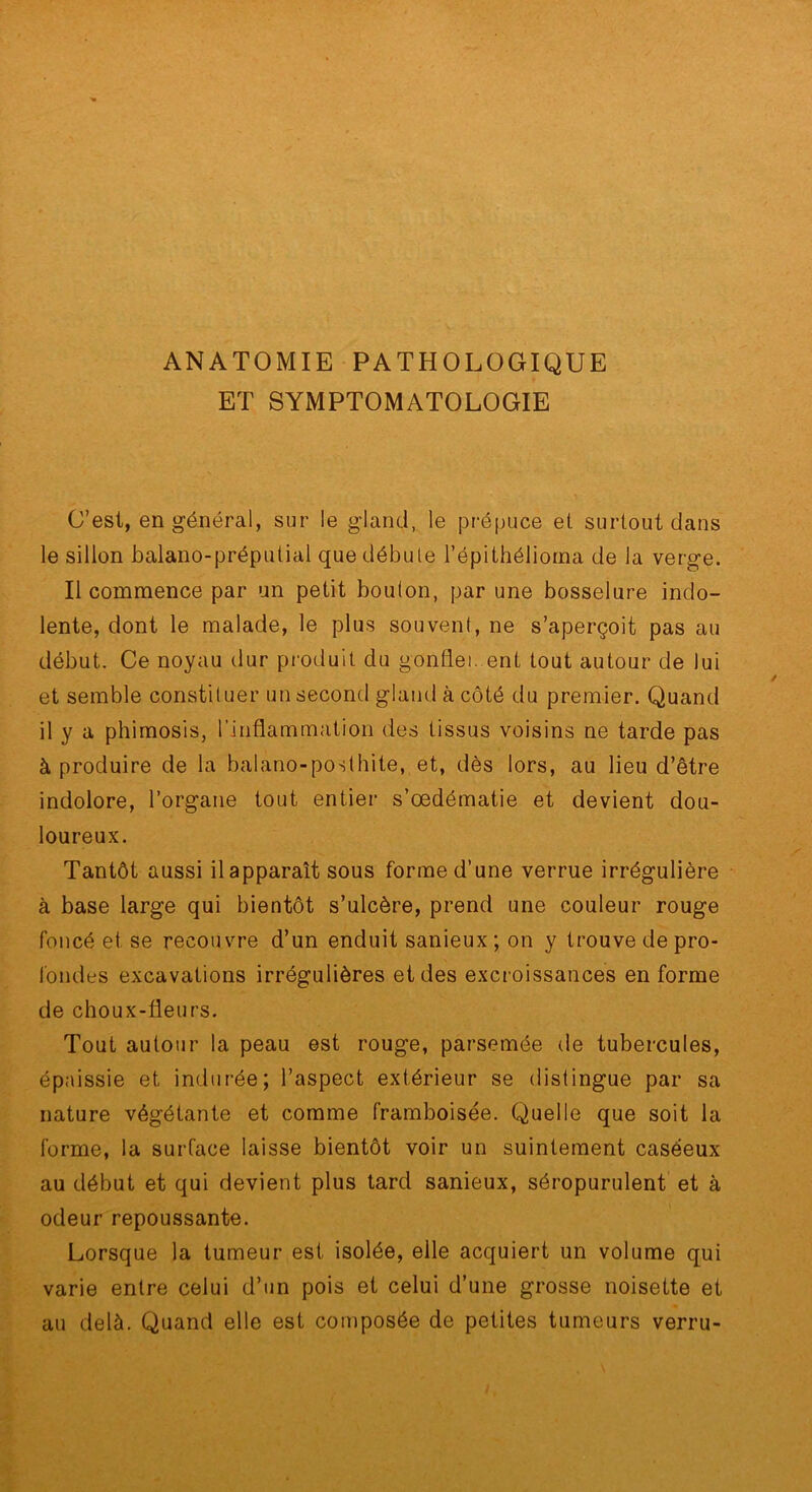 ANATOMIE PATHOLOGIQUE ET SYMPTOMATOLOGIE C’est, en général, sur le gland, le prépuce et surtout dans le sillon balano-préputial que débute l’épithéliorna de la verge. Il commence par un petit bouton, par une bosselure indo- lente, dont le malade, le plus souvent, ne s’aperçoit pas au début. Ce noyau dur produit du gonflei. ent tout autour de lui et semble constituer un second gland à côté du premier. Quand il y a phimosis, l’inflammation des tissus voisins ne tarde pas à produire de la balano-posthite, et, dès lors, au lieu d’être indolore, l’organe tout entier s’œdématie et devient dou- loureux. Tantôt aussi il apparaît sous forme d’une verrue irrégulière à base large qui bientôt s’ulcère, prend une couleur rouge foncé et se recouvre d’un enduit sanieux; on y trouve de pro- l'ondes excavations irrégulières et des excroissances en forme de choux-fleurs. Tout autour la peau est rouge, parsemée de tubercules, épaissie et indurée; l’aspect extérieur se distingue par sa nature végétante et comme framboisée. Quelle que soit la forme, la surface laisse bientôt voir un suintement caséeux au début et qui devient plus tard sanieux, séropurulent et à odeur repoussante. Lorsque la tumeur est isolée, elle acquiert un volume qui varie entre celui d’un pois et celui d’une grosse noisette et au delà. Quand elle est composée de petites tumeurs verru-