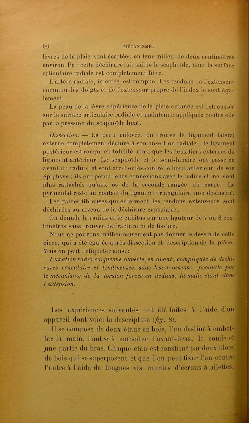 lèvres de la plaie sont écartées en leur milieu de deux centimètres environ. Par celte déchirure tait saillie le scaphoïde, dont la surface articulaire radiale est complètement libre. La peau de la lèvre supérieure de la plaie cutanée est retroussée sur la surface articulaire radiale et maintenue appliquée contre elle par la pression du scaphoïde luxé. Les expériences suivantes ont été faites à l’aide d’un appareil dont voici la description [fig. 8). Il se compose de deux étaus en bois, l’un destiné à emboî- ter la main, l’autre à emboîter l’avant-bras, le coude et .une partie du bras. Chaque étau est constitué par deux blocs de bois qui se superposent et que l’on peut fixer l’un contre L’artère radiale, injectée, est rompue. Les tendons de l’extenseur commun dés doigts et de l’extenseur propre de l'index le sont éga- f lement. *