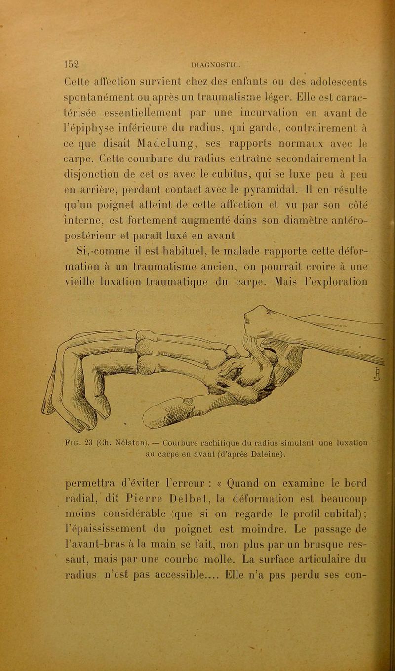 r-.: ' ‘ ti; K Fig. 23 (Gh. Nélaton),^— Courbure rachitique du radius simulant une luxation au carpe en avant (d’après Daleine). permettra d’éviter l’erreur : « Quand on examine le bord radial, dit Pierre Delbet, la déformation est beaucoup moins considérable (que si on regarde le profil cubital) ; l’éjiaississement du poignet est moindre. Le passage de l’avant-bras à la main se fait, non plus par un brusque res- '] saut, mais par une courbe molle. La surface articulaire duj radius n’est pas accessible.,.. Elle n’a pas perdu ses con- | 152 DIAGNOSTIC. Celle afîection survient chez des enfants ou des adolescents spontanément ou après un traumatisme léger. Elle est carac- térisée essentiellement par une incurvation en avant de l’épiphyse inférieure du radius, qui garde, contrairement à ce que disait Madelung, ses rapports normaux avec le carpe. Cette courbure du radius entraîne secondairement la disjonction de cet os avec le cubitus^ qui se luxe peu à peu en arrière, perdant contact avec le pyramidal. 11 en résulte qu’un poignet atteint de cette affection et vu par son côté interne, est fortement augmenté dans son diamètre antéro- postérieur et paraît luxé en avant. Si,-comme il est habituel, le malade rapporte cette défor- mation à un traumatisme ancien, on pourrait croire à une vieille luxation traumatique du carpe. Mais l’exploration