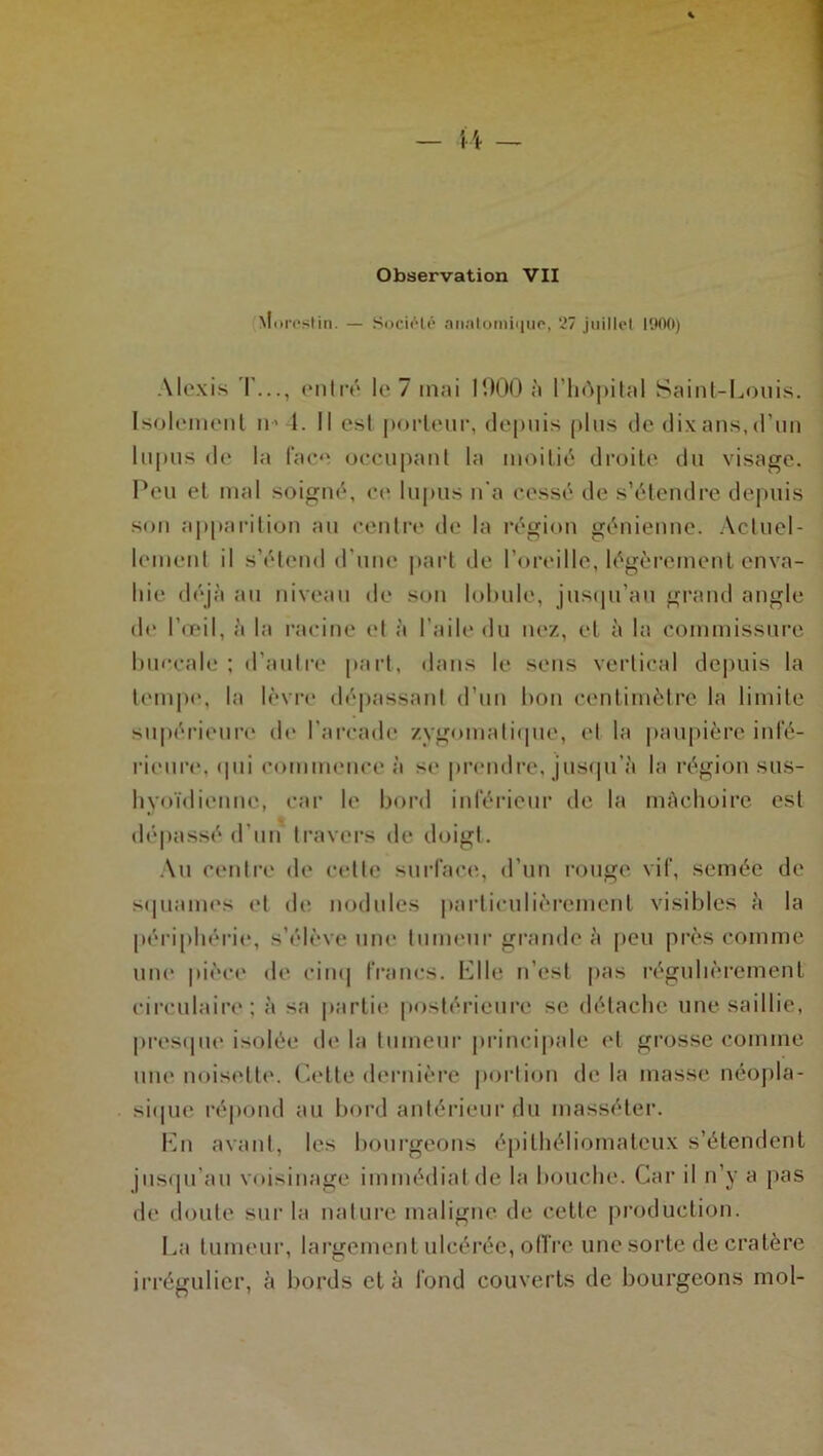 Mores!in. — Société anatomique, 27 juillet 1200) Alexis T..., entré le 7 mai 1000 à l’hôpital Saint-Louis. Isolement ii'4. Il est porteur, depuis plus de dixans.d’un lupus de la face occupant la moitié droite du visage. Peu et mal soigné, ce lupus n’a cessé de s’étendre depuis son apparition au centre de la région génienne. Actuel- lement il s’étend d’une part de l’oreille, légèrement enva- hie déjà au niveau de son lobule, jusqu’au grand angle de l’œil, à la racine et à l’aile du nez, et à la commissure buccale ; d’autre part, dans le sens vertical depuis la tempe, la lèvre dépassant d’un bon centimètre la limite supérieure (h* l’arcade zygomatique, et la paupière infé- rieure. (pii commence à se prendre, jusqu’à la région sus- hyoïdienne, car le bord inférieur de la mâchoire est dépassé d'un travers de doigt. Au centre de cette surface, d’un rouge vif, semée de squames et de nodules particulièrement visibles à la périphérie, s’élève une tumeur grande à peu près comme une pièce de cinq francs. Elle n’est pas régulièrement circulaire; à sa partie postérieure se détache une saillie, presque isolée de la tumeur principale et grosse comme une noisette. Cette dernière portion de la masse néopla- sique répond au bord antérieur du masséter. En avant, les bourgeons épilhéliomateux s’étendent jusqu'au voisinage immédiat de la bouche. Car il n’y a pas de doute sur la nature maligne de cette production. La tumeur, largement ulcérée, offre une sorte de cratère irrégulier, à bords cl à fond couverts de bourgeons mol-